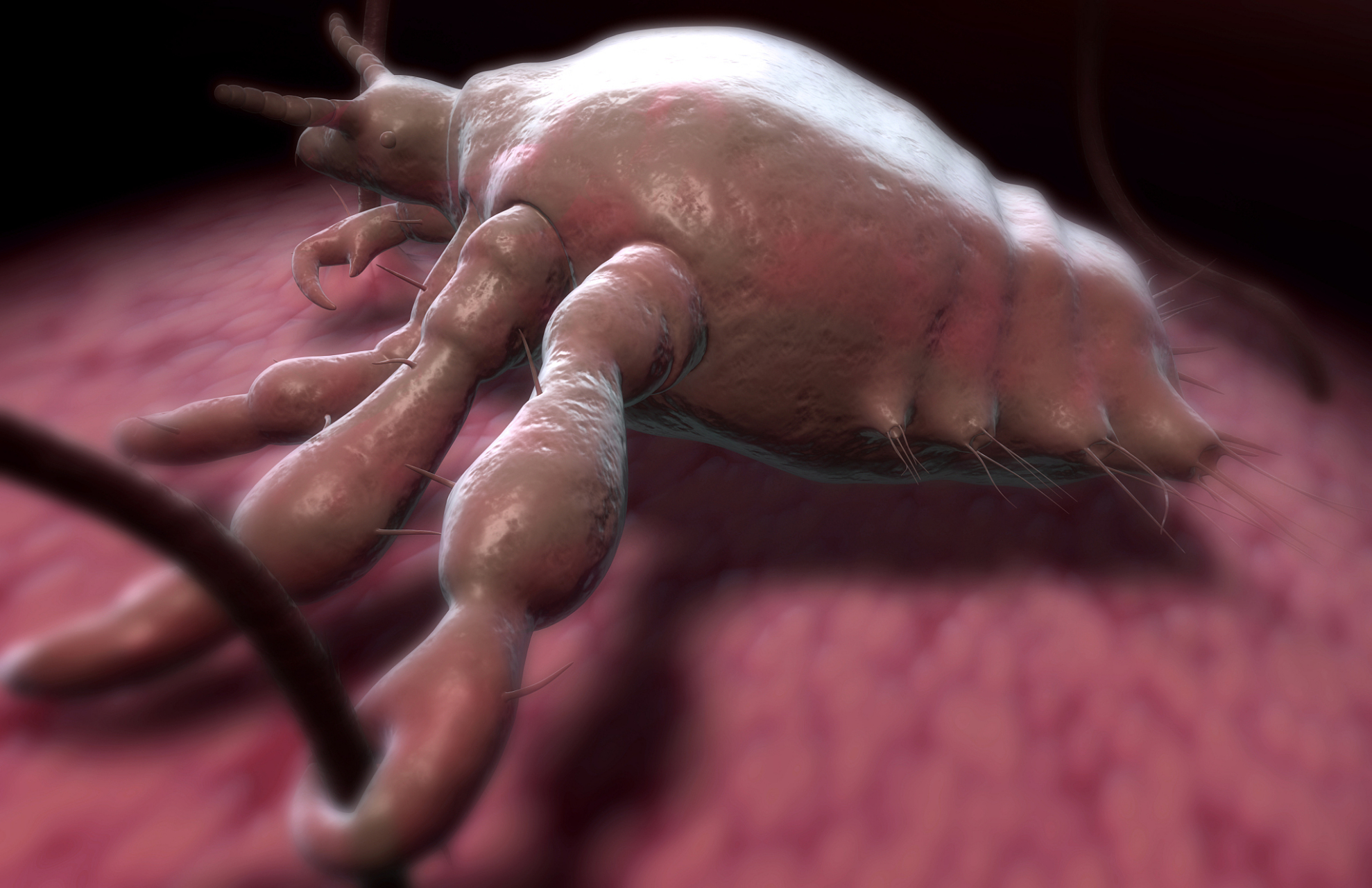 男友出差一星期,染上了阴虱病,我每天跟他同床共枕,会感染上这个病吗?