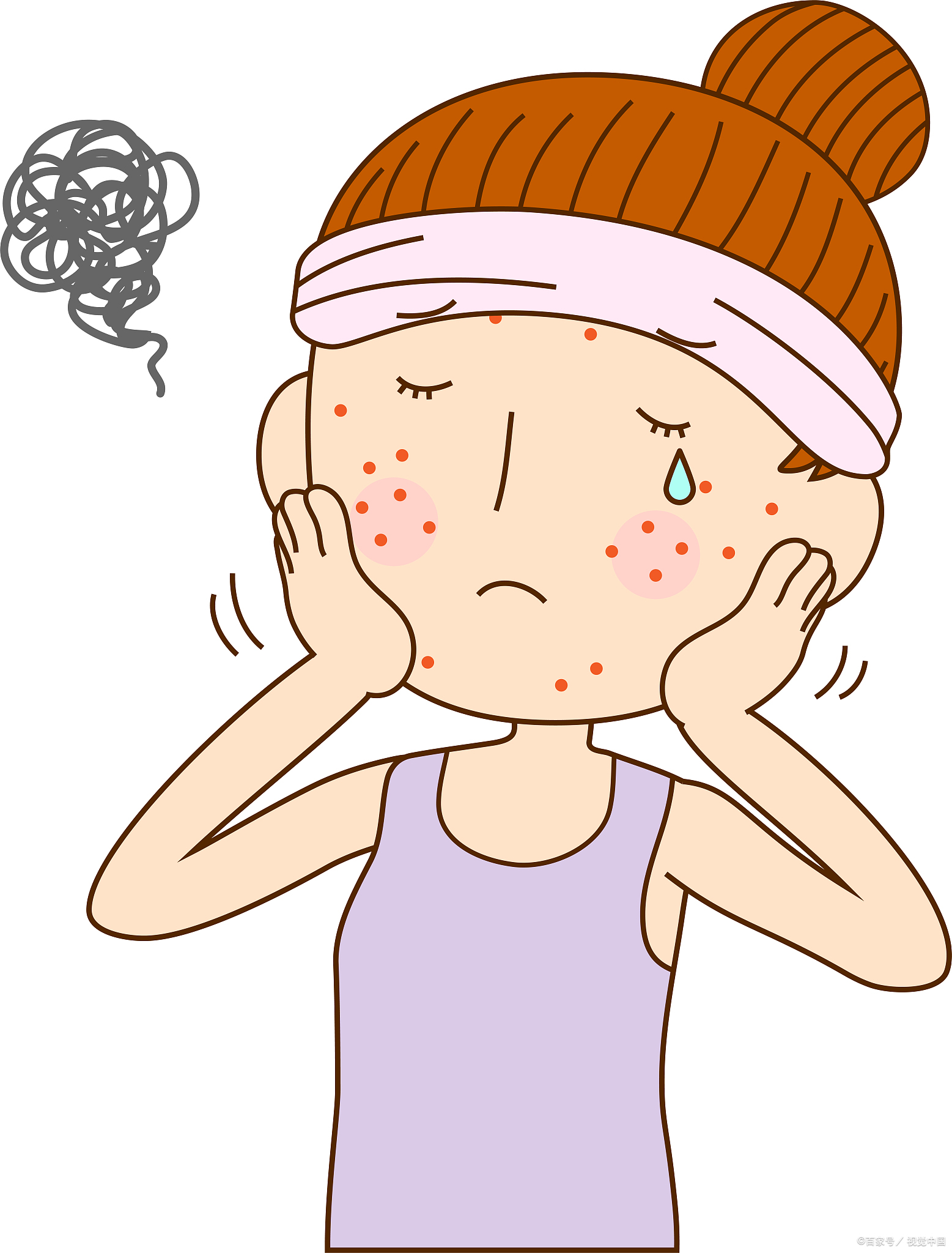 敏感肌是皮肤高反应状态,核心是屏障功能受损,角质层防御下降,易受