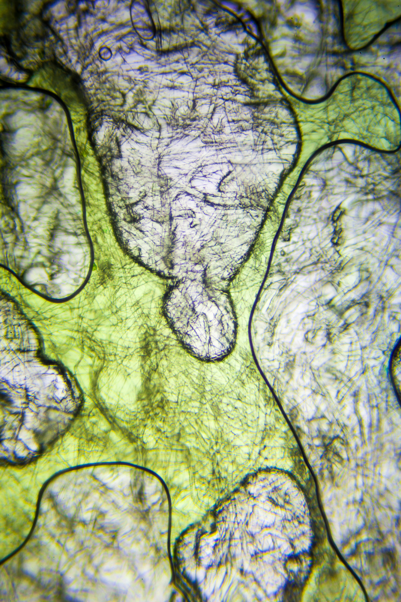 一个充满爱意的亲吻可能变成孩子的"毒药"