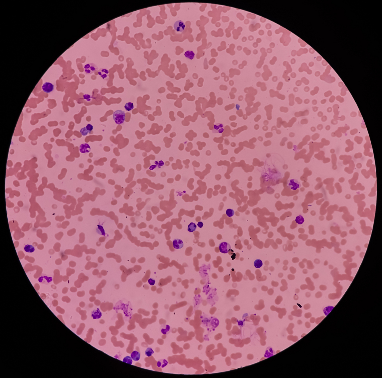 支原体污染的来源  (1)细胞之间交叉污染;  (2)细胞培养操作人员的