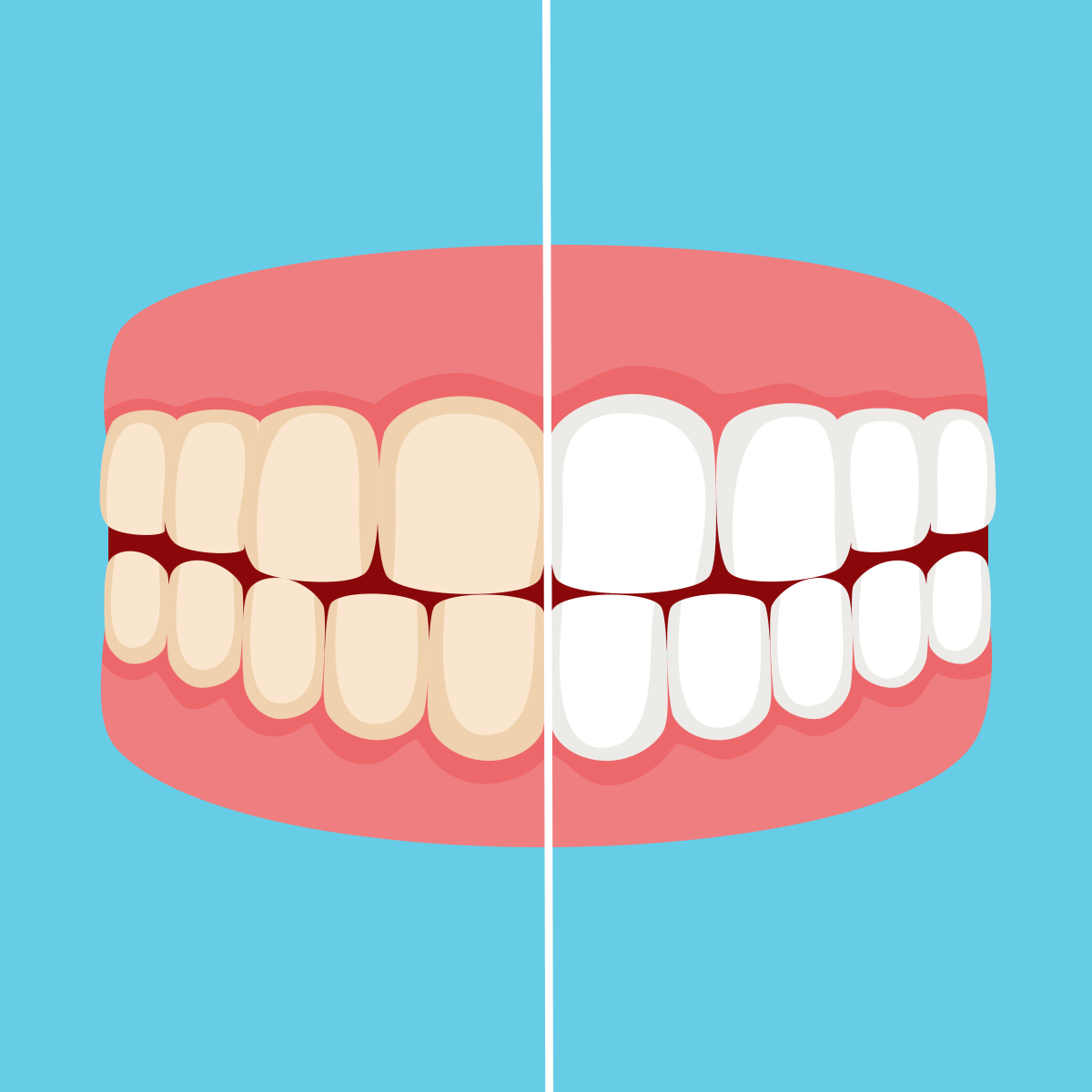使牙污渍牙齿卡通图片牙齿变白牙齿发黄卡通图片牙齿变黄卡通牙齒的