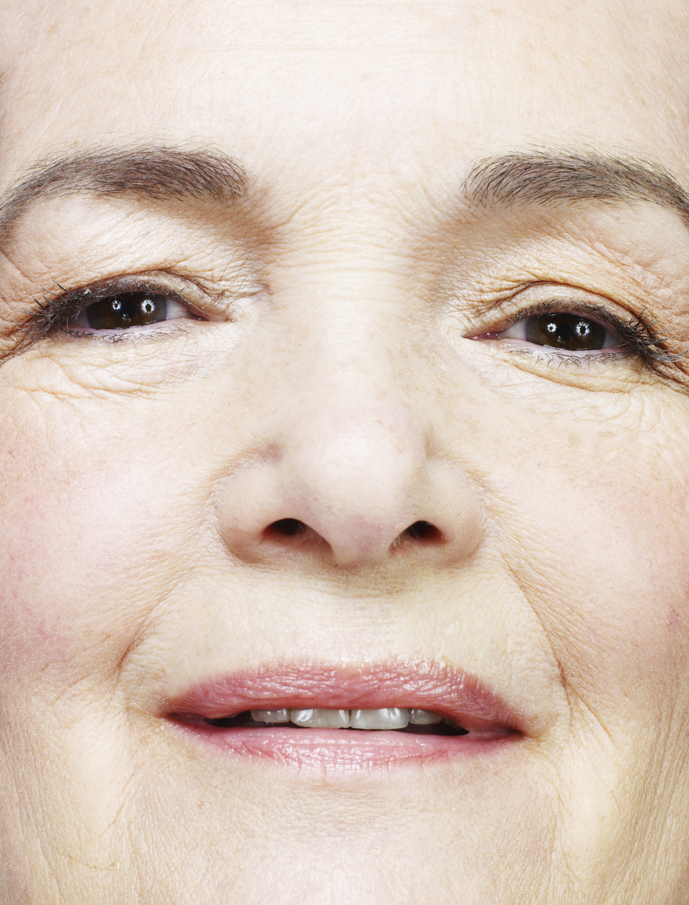 法令纹去除小妙招,坚持跑步可以让法令纹消失吗?