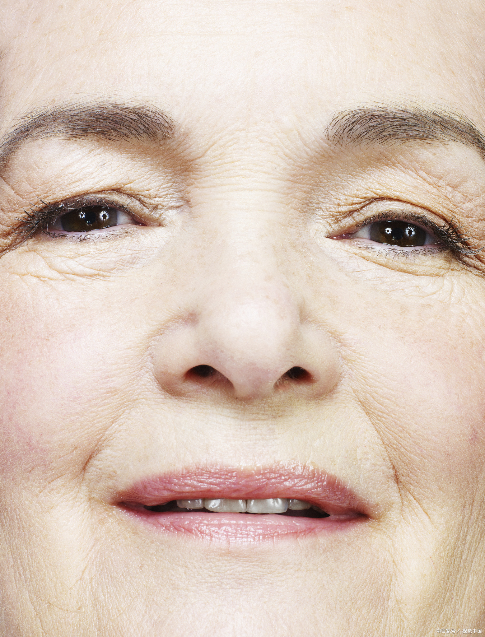 额头,眼角的皱纹很,有哪些方法可以改善?