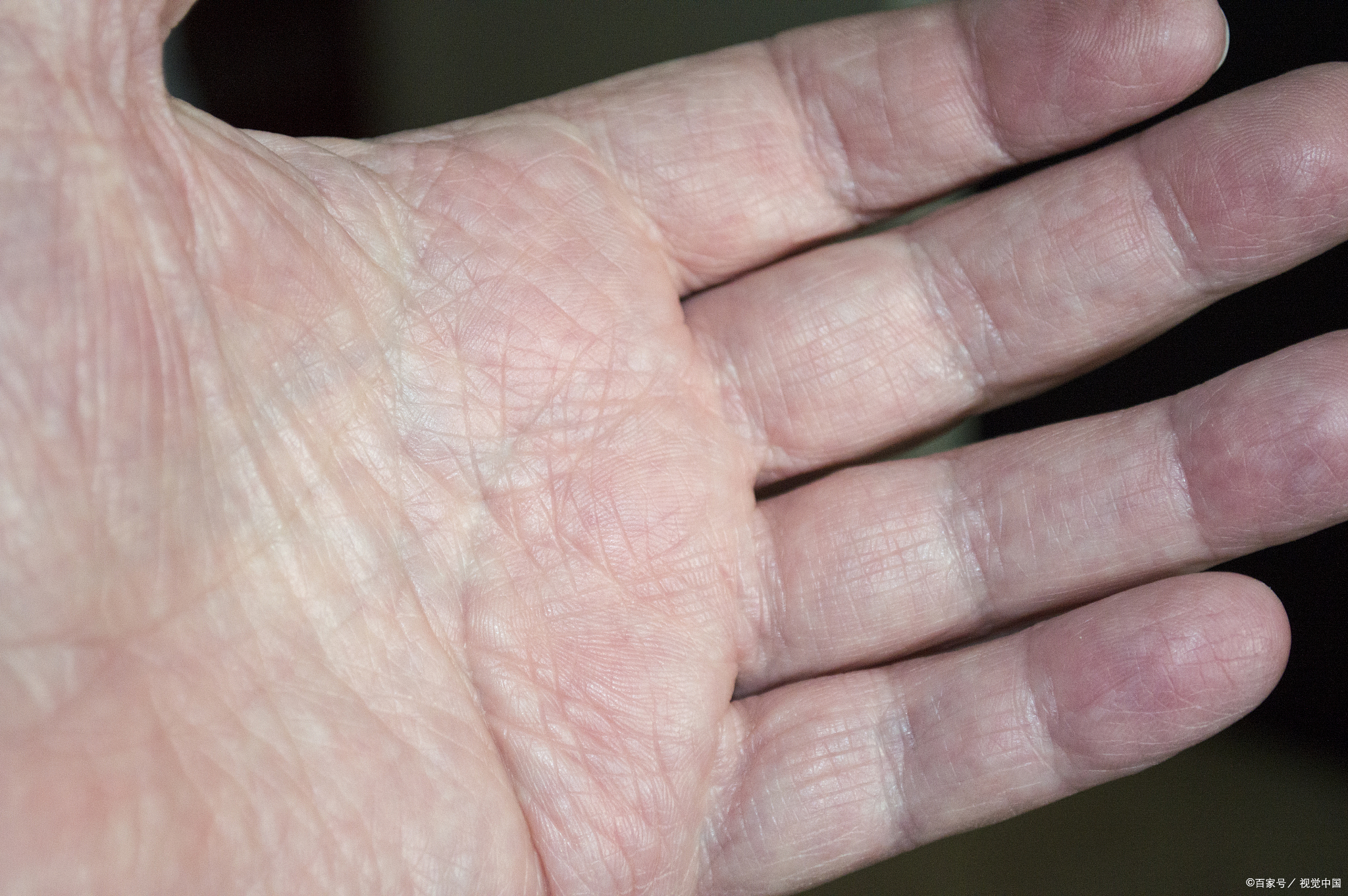 新技术快速识别人体手掌静脉纹路