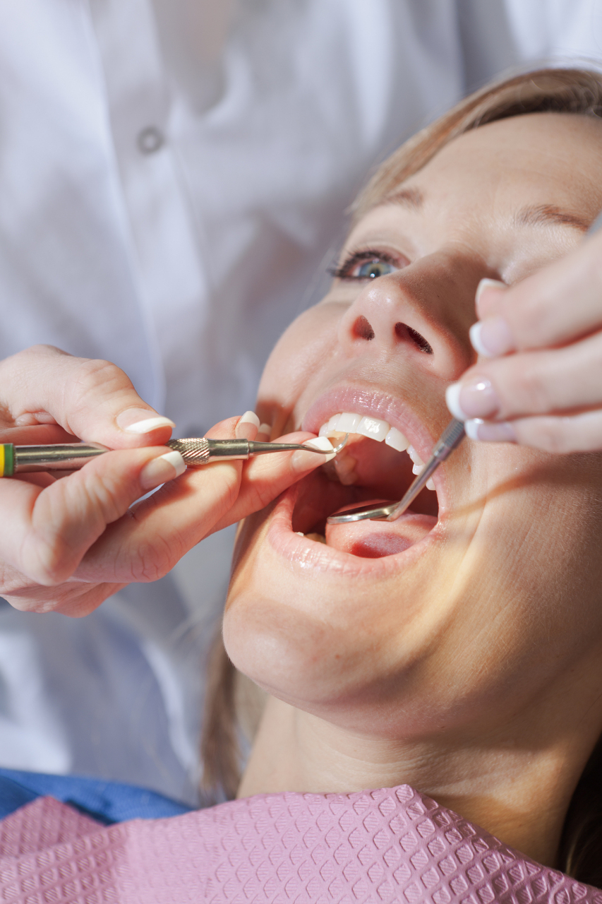 拔牙可以瘦脸?拔智齿真的可以瘦脸吗?