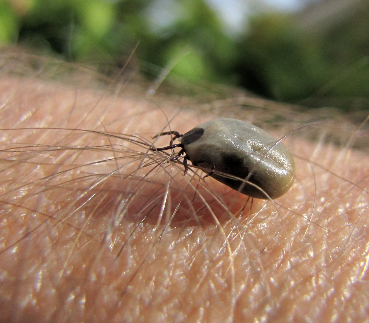 蜱虫寄生在人体后的确可能传播多种病原体,因此我们应该采取正确的
