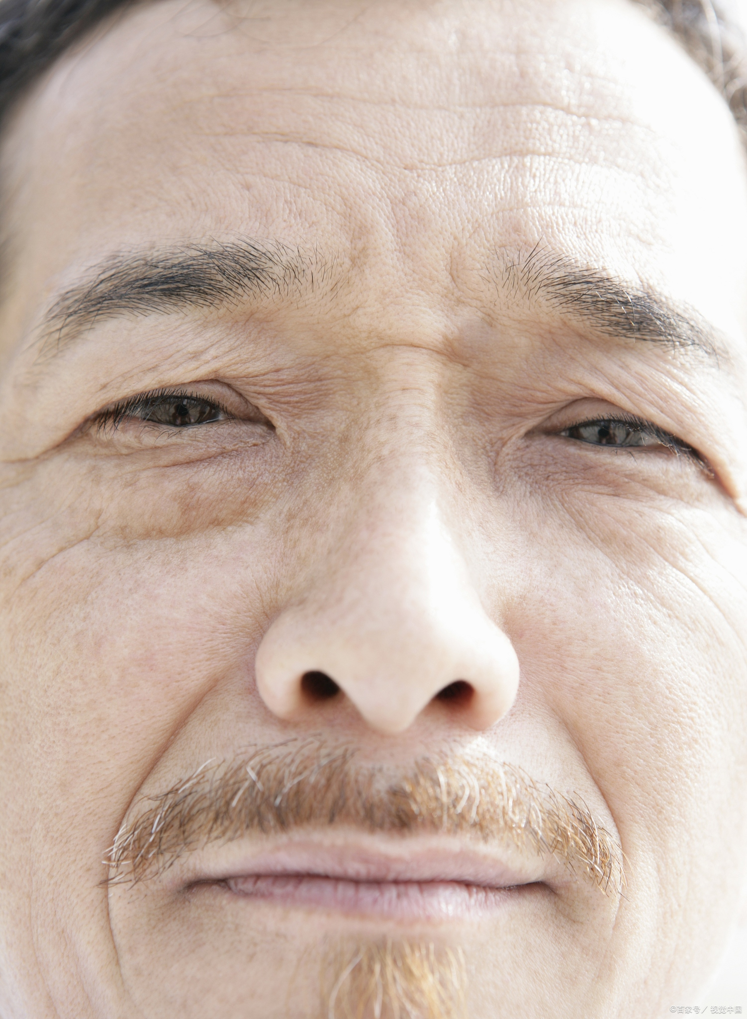 胶原填充可以去除抬头纹吗?