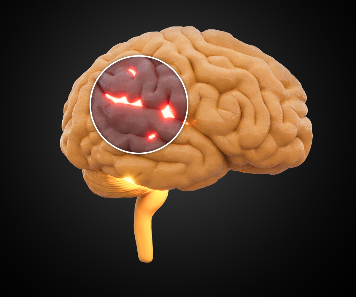 Phenothiazine uses | Shaanxi BLOOM Tech Co., Ltd Phenothiazine uses | Shaanxi BLOOM Tech Co., Ltd