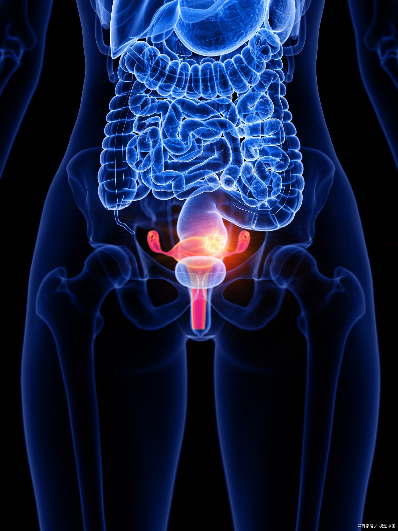 膀胱炎久治不愈是什么原因