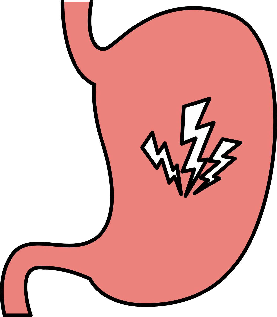 以下是一些可能导致经常胃酸的原因:  11566 饮