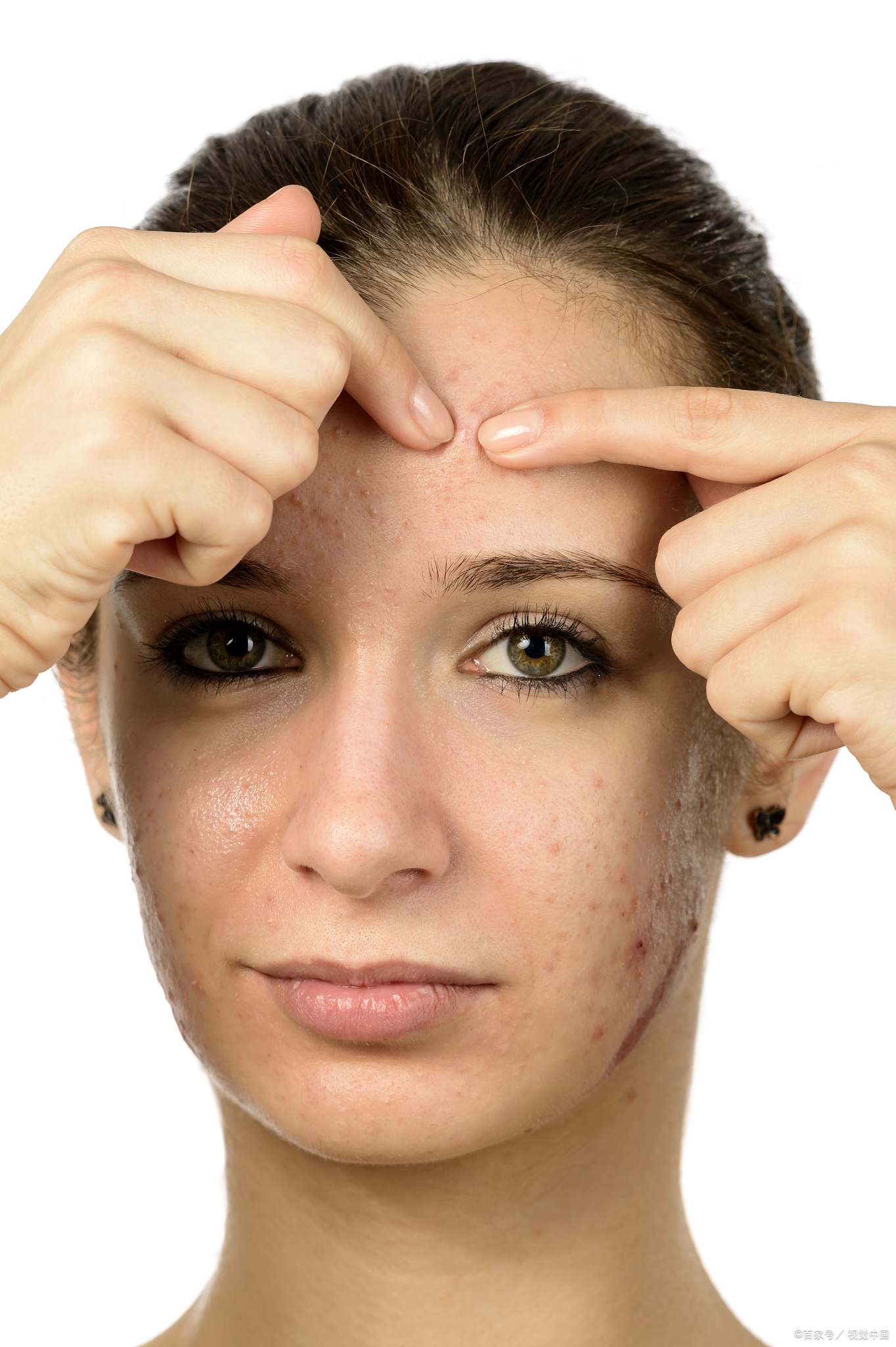 油性皮肤怎么改善肤质?告别油光满面,打造水润透亮肌肤