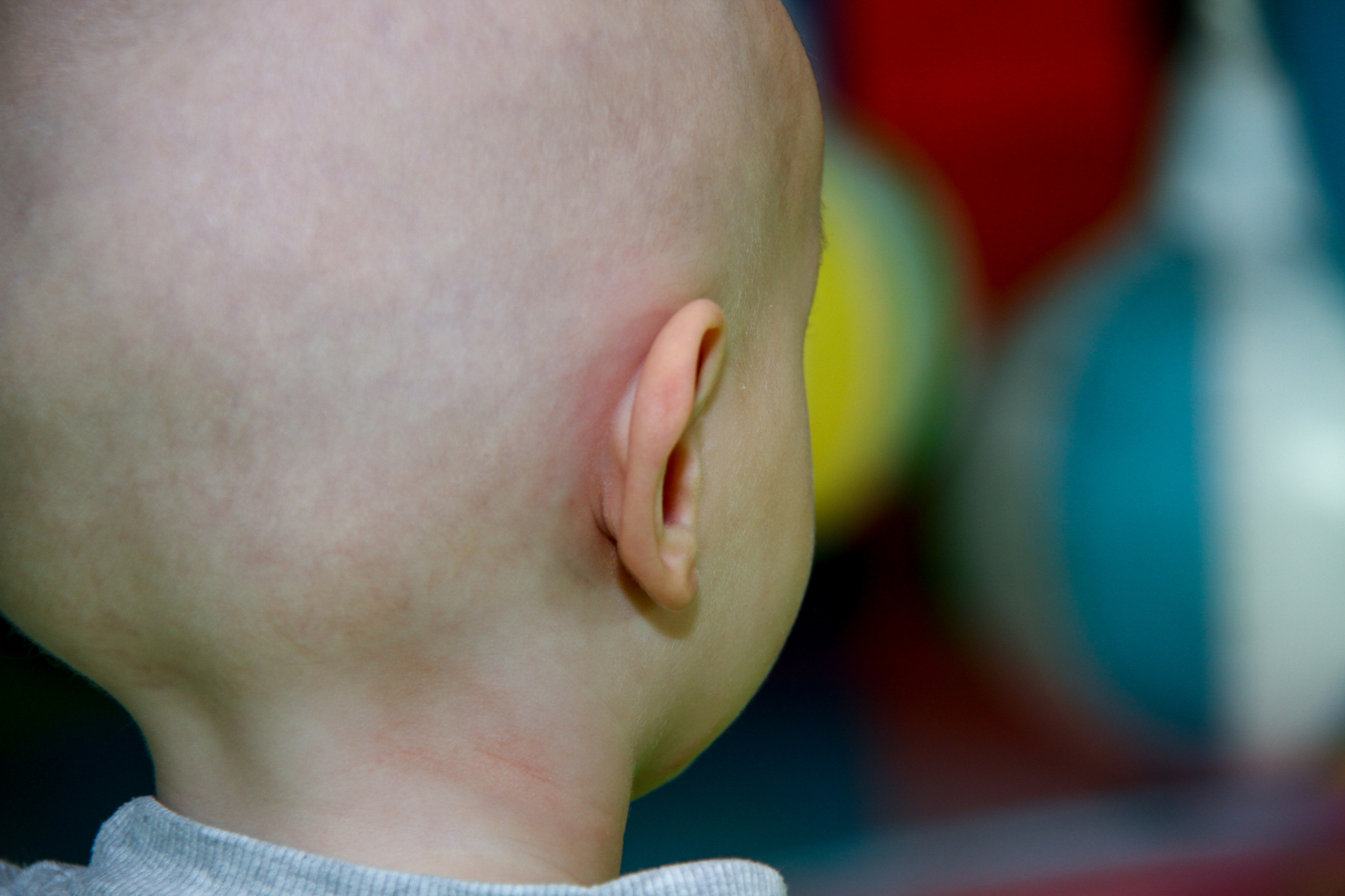 瘤:病因,症状和治疗的全面介绍 儿童淋巴瘤是一种常见的儿童恶性肿瘤