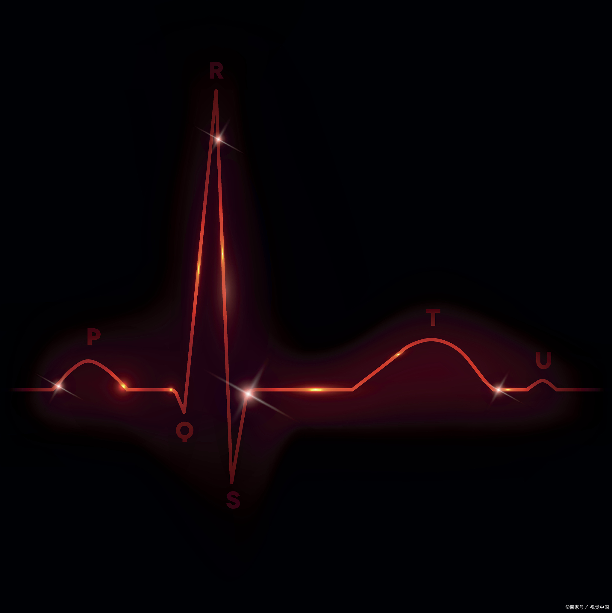 心电图作为体检中的常规项目,对于及早发现心脏问题具有重要意义