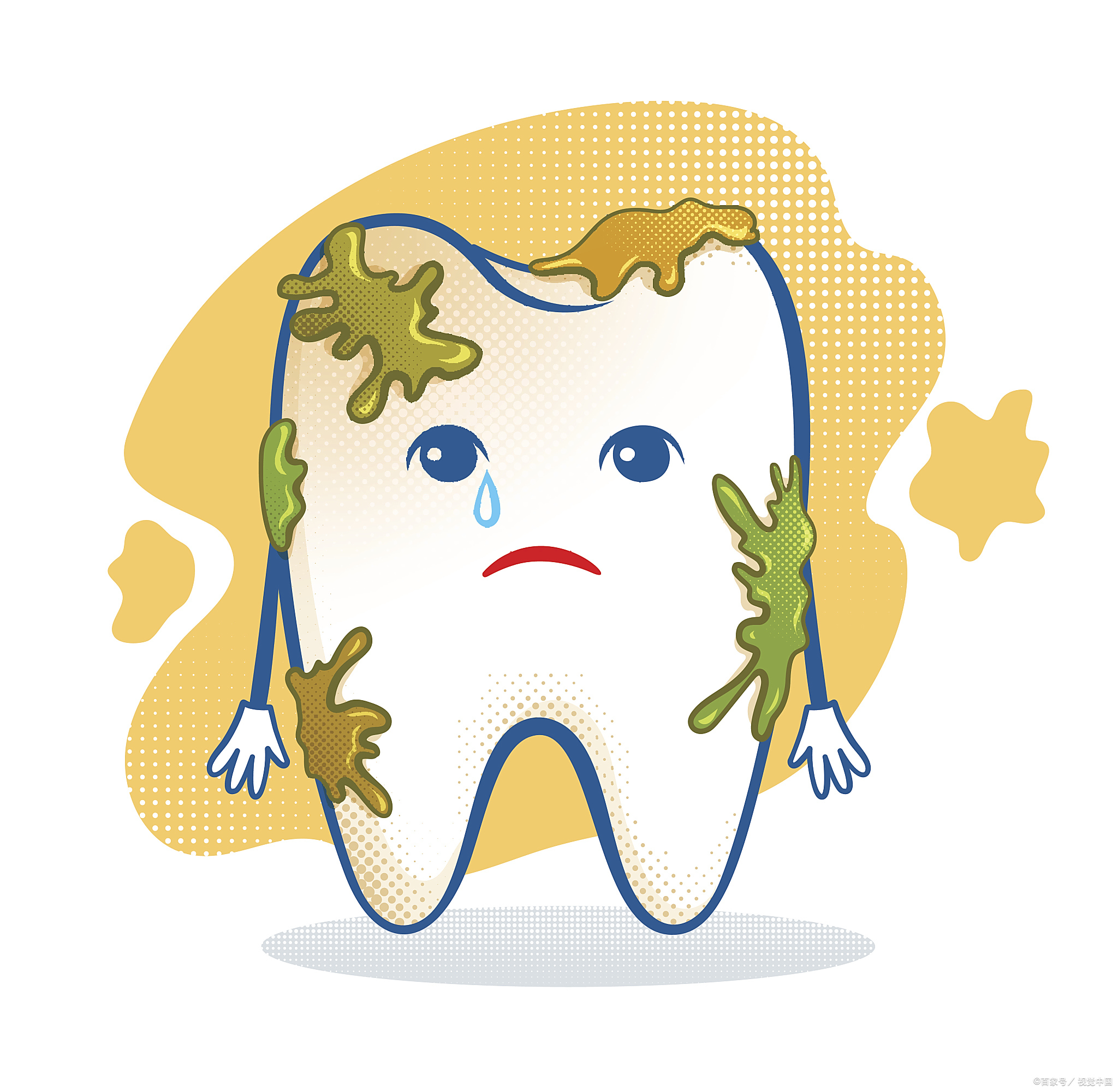 牙氟氟斑牙卡通简化图产酸腐蚀牙齿卡通龋齿的过程儿童牙齿龋坏的图片