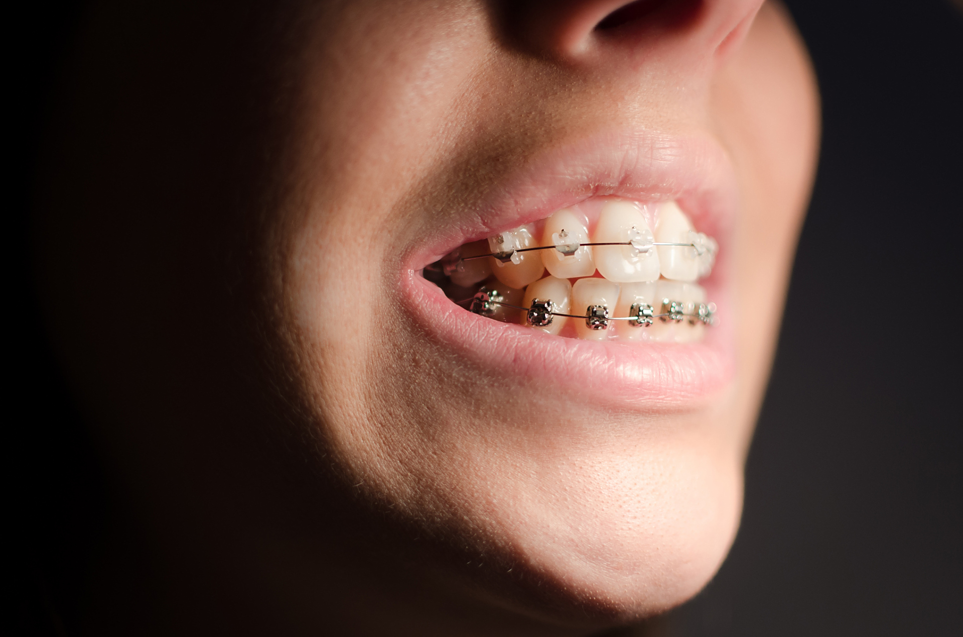 想要让孩子拥有漂亮整齐的牙齿吗?