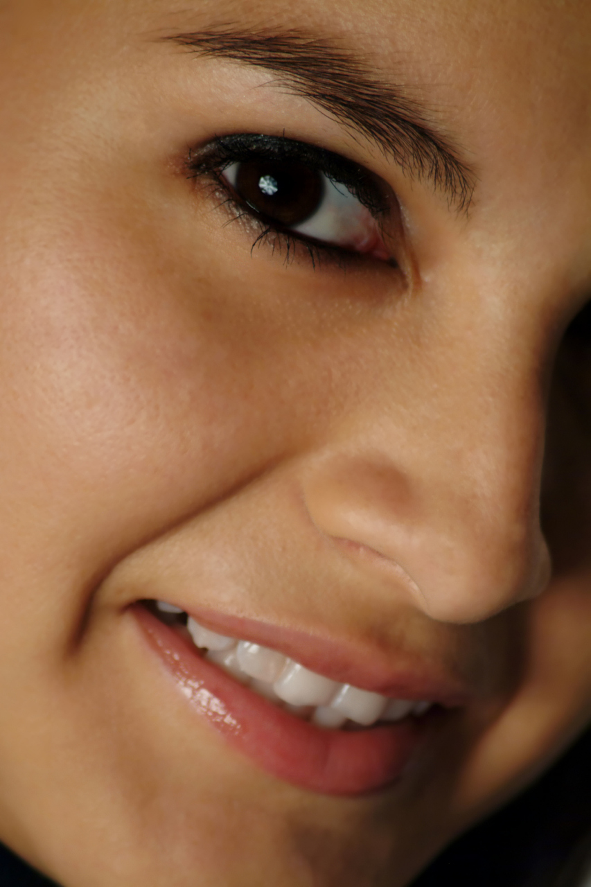 嘴巴两边是什么纹 #医美#   嘴巴两边出现的纹路通常是笑纹,也被称为