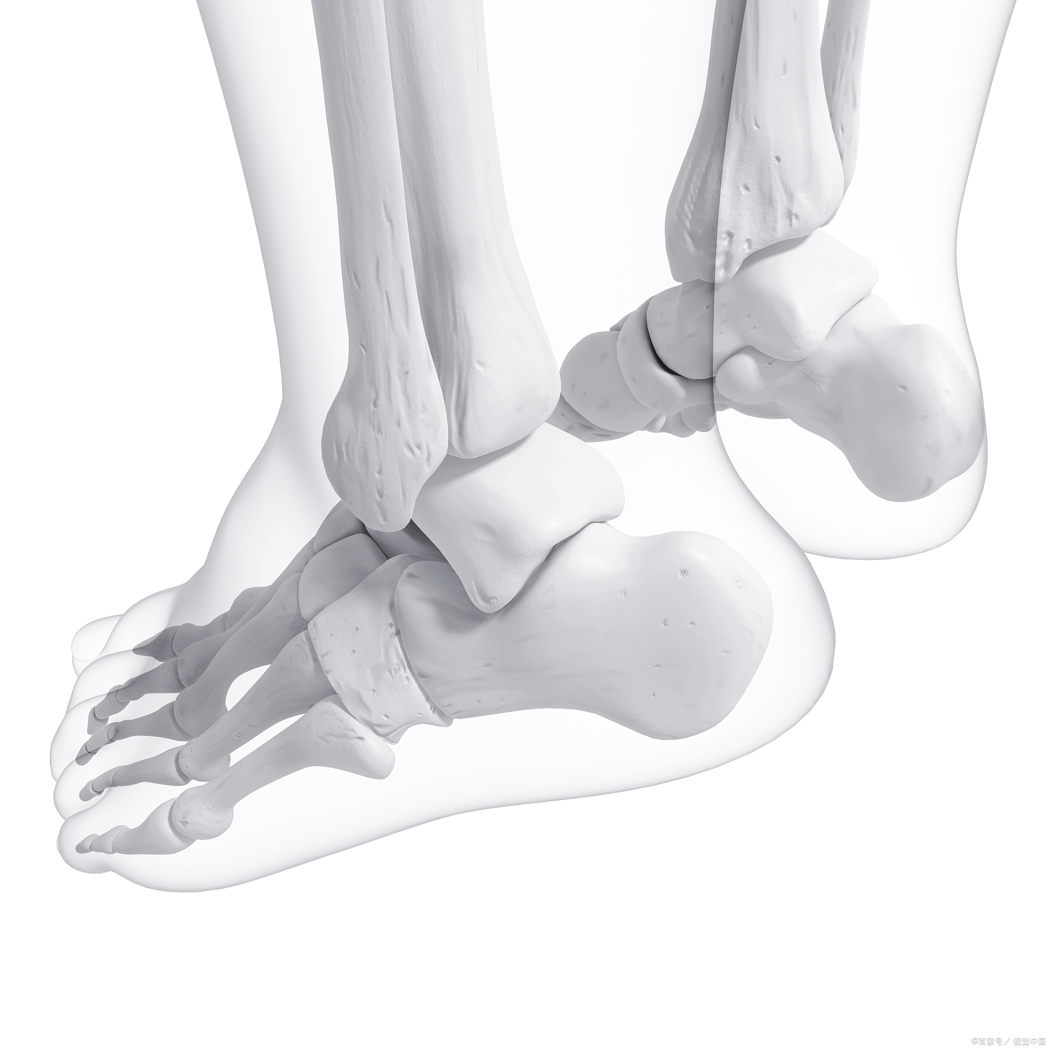 大脚骨怎么医治:告别大脚骨困扰,治疗妙招一一呈现 大脚骨,医学上称为