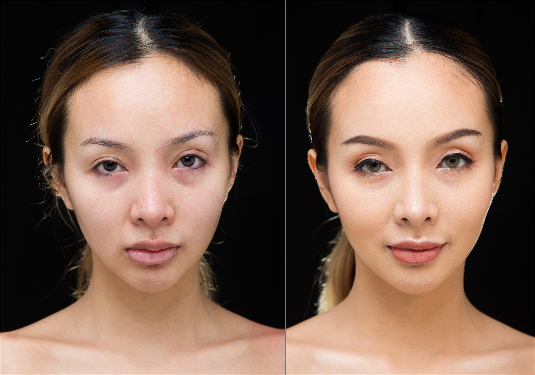 面部填充可以保持多久  面部填充所用的材料和填充的组织与填充效果的