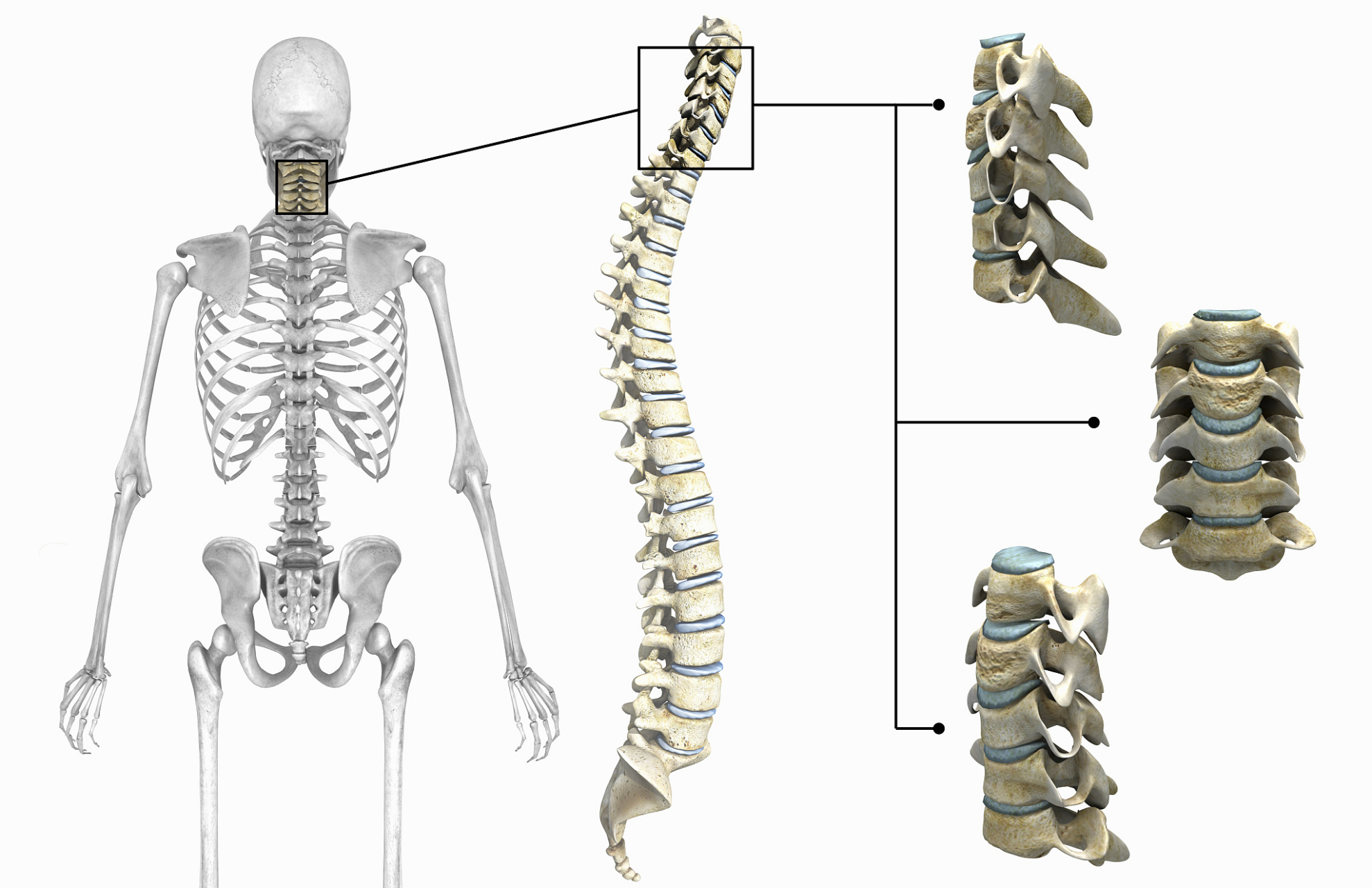 大多数科学家认为这是一种先天性畸形,可导致早期胎