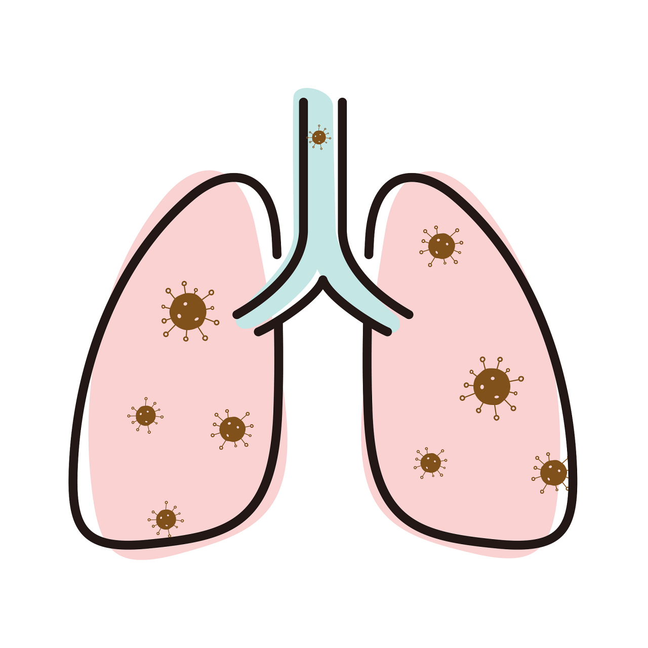 肺结核:感染之源与防护之道 98肺结核,如今在医学的进步下已不再是