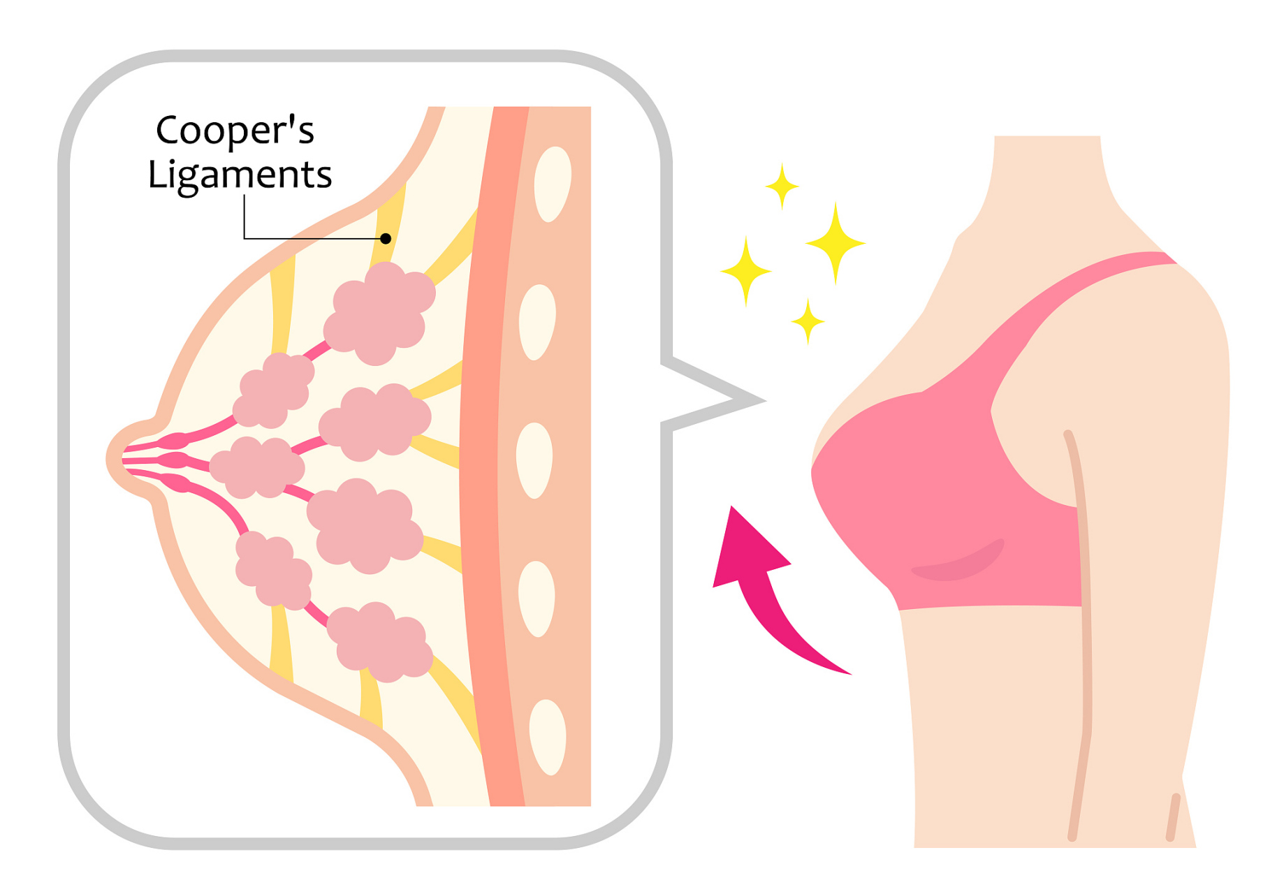 但是,韦叔认为胶原蛋白丰胸的性价比确实是比较低的.