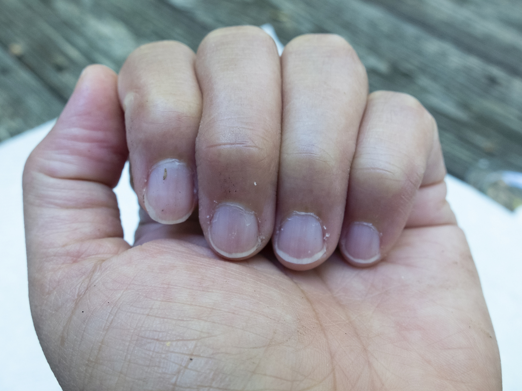 月牙是指甲床上半月形的白色弧形区域,它实际上是指甲床下的一部分.