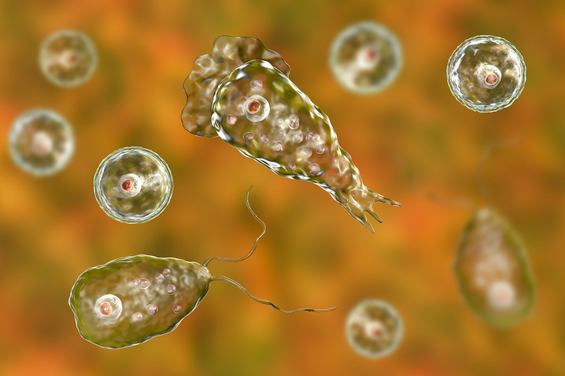 美国佛罗里达州一名男子,涉嫌用未经处理的自来水清洗鼻腔,导致食脑虫