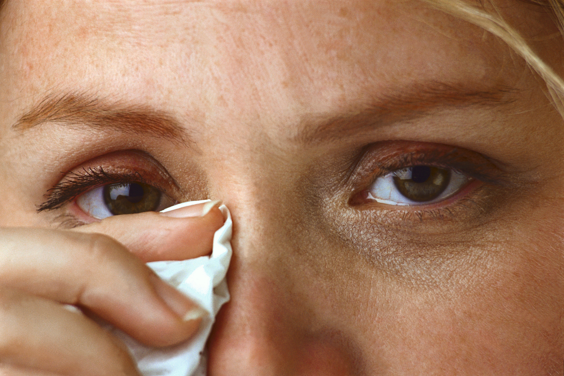 干眼是指由于眼睛泪液分泌不足或泪液质量异常而导致的眼部不适症状