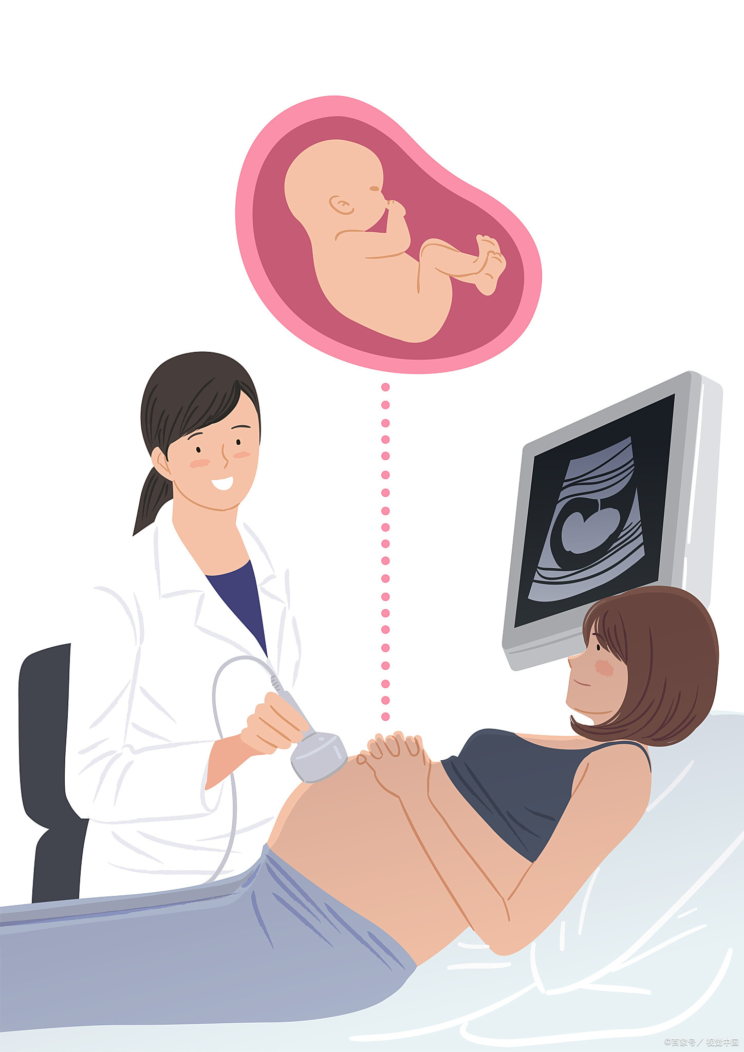 胎心160次/分,这一数值对于许多准父母而言,无疑是