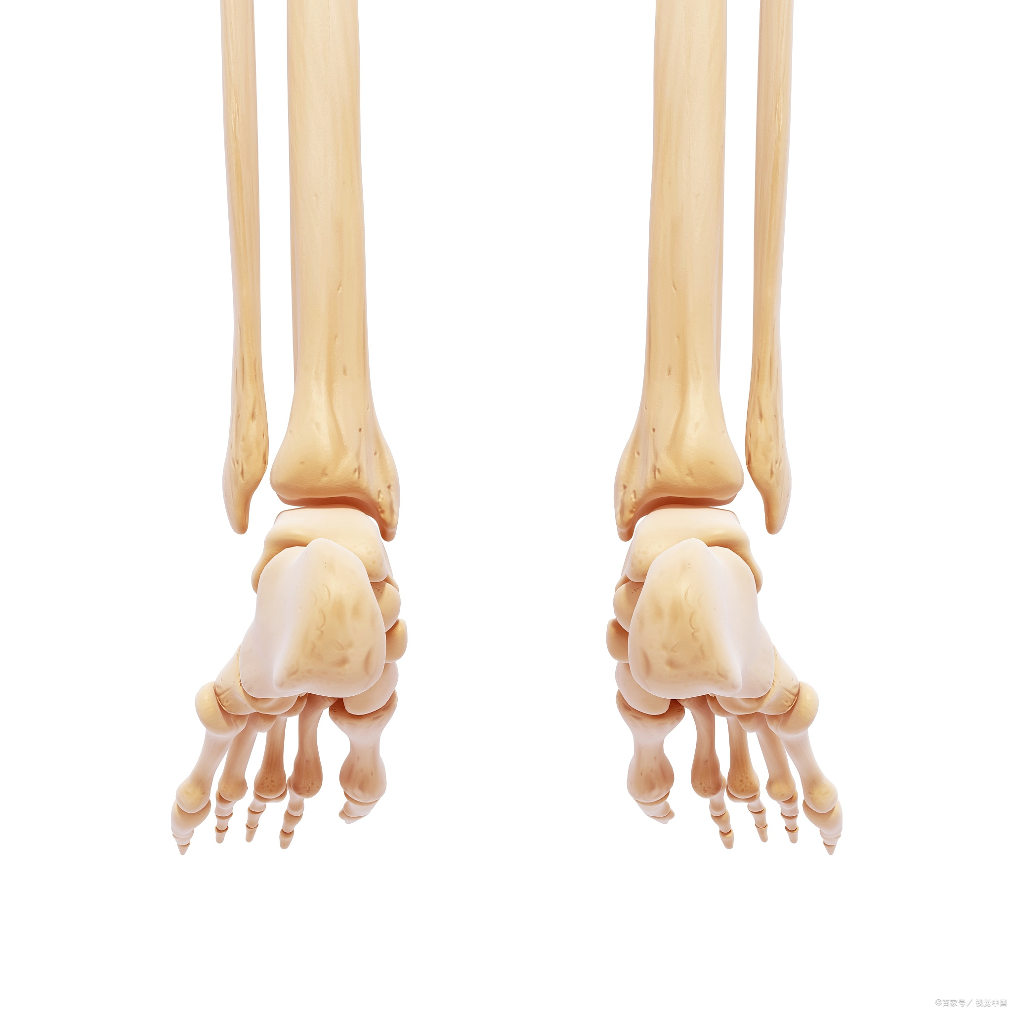 大脚骨怎么医治:告别大脚骨困扰,治疗妙招一一呈现