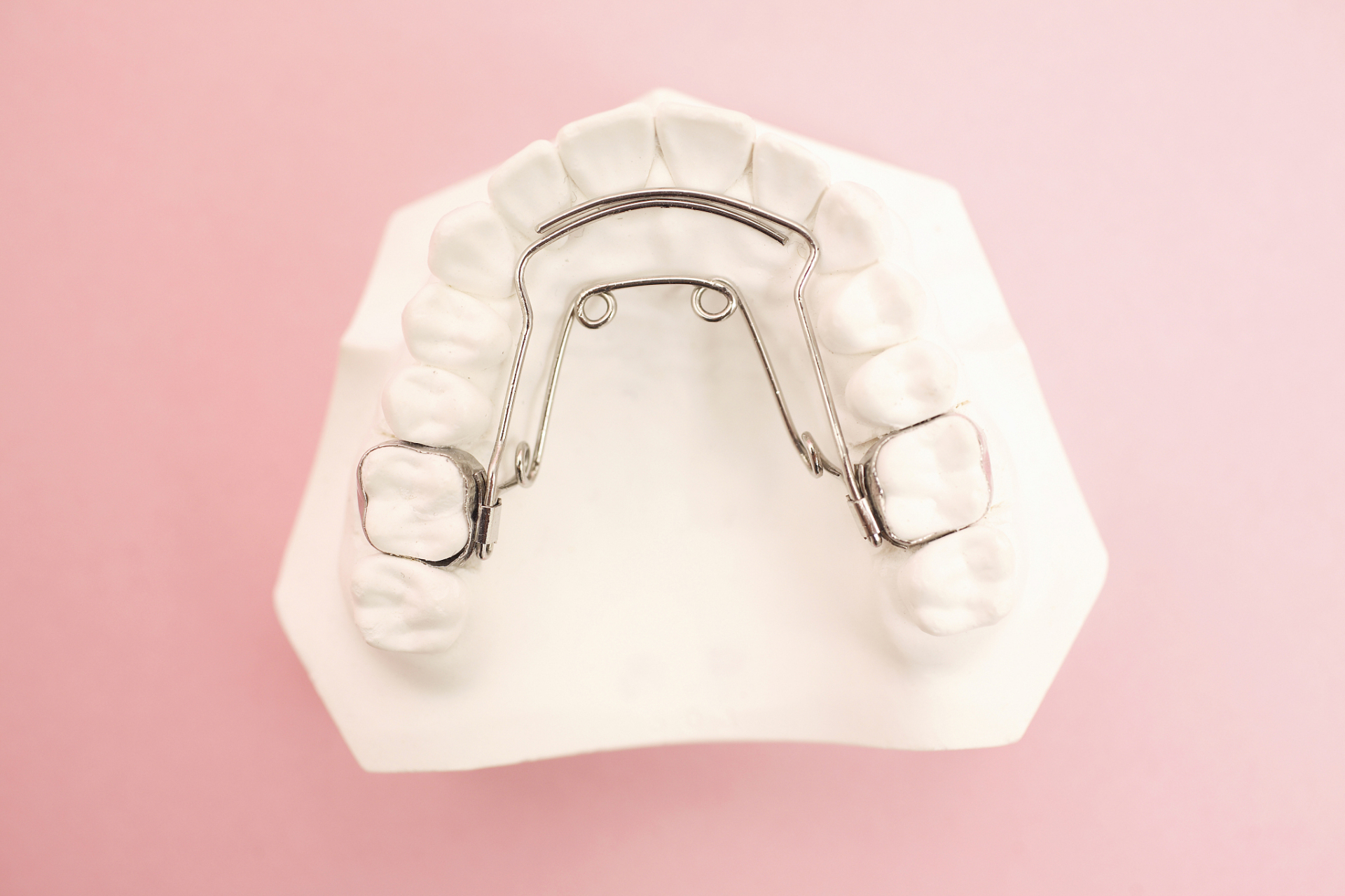 🦷你是否正在考虑进行牙齿矫正,但不知道该选择哪种托槽?