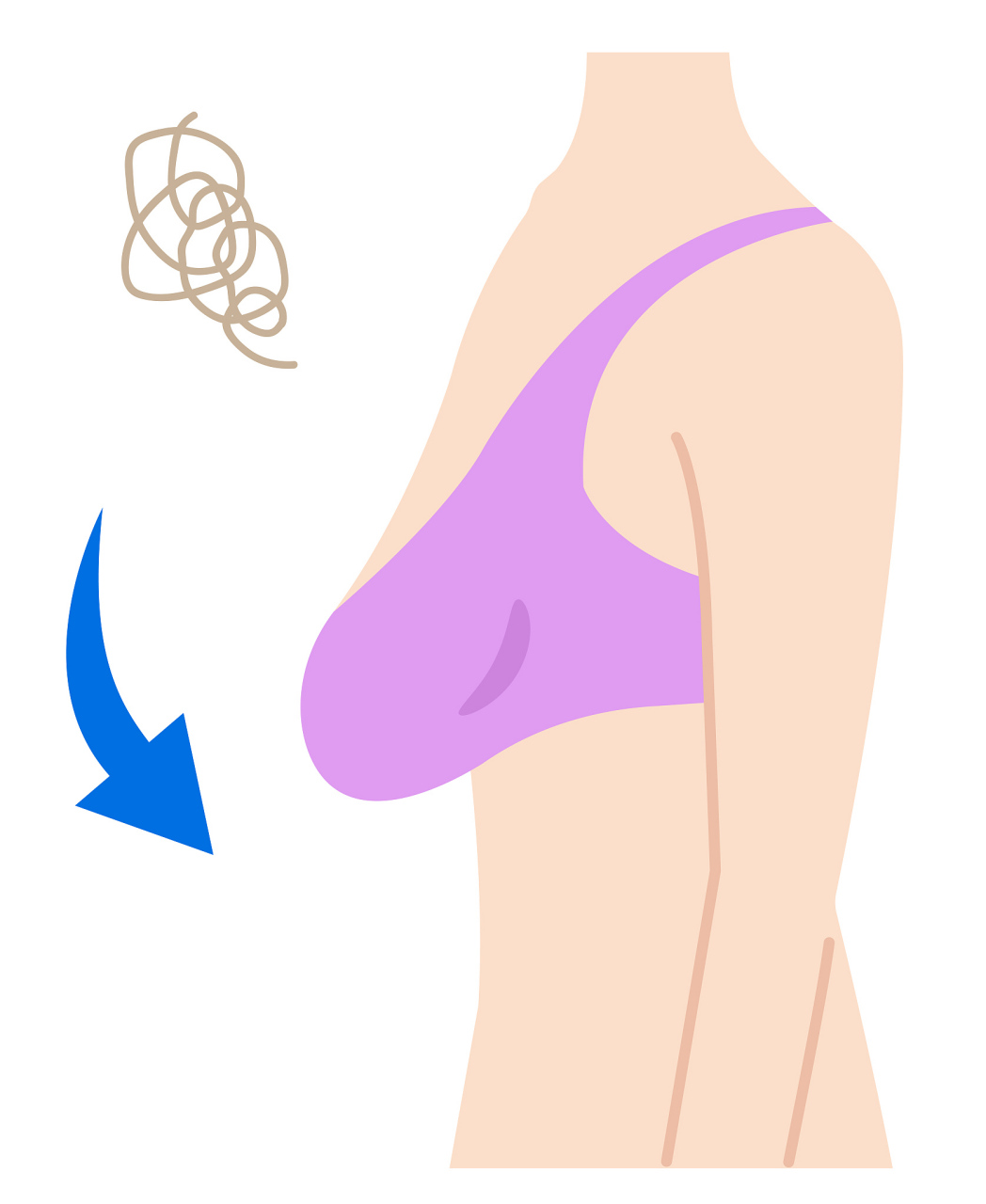 乳房干瘪一层皮图片