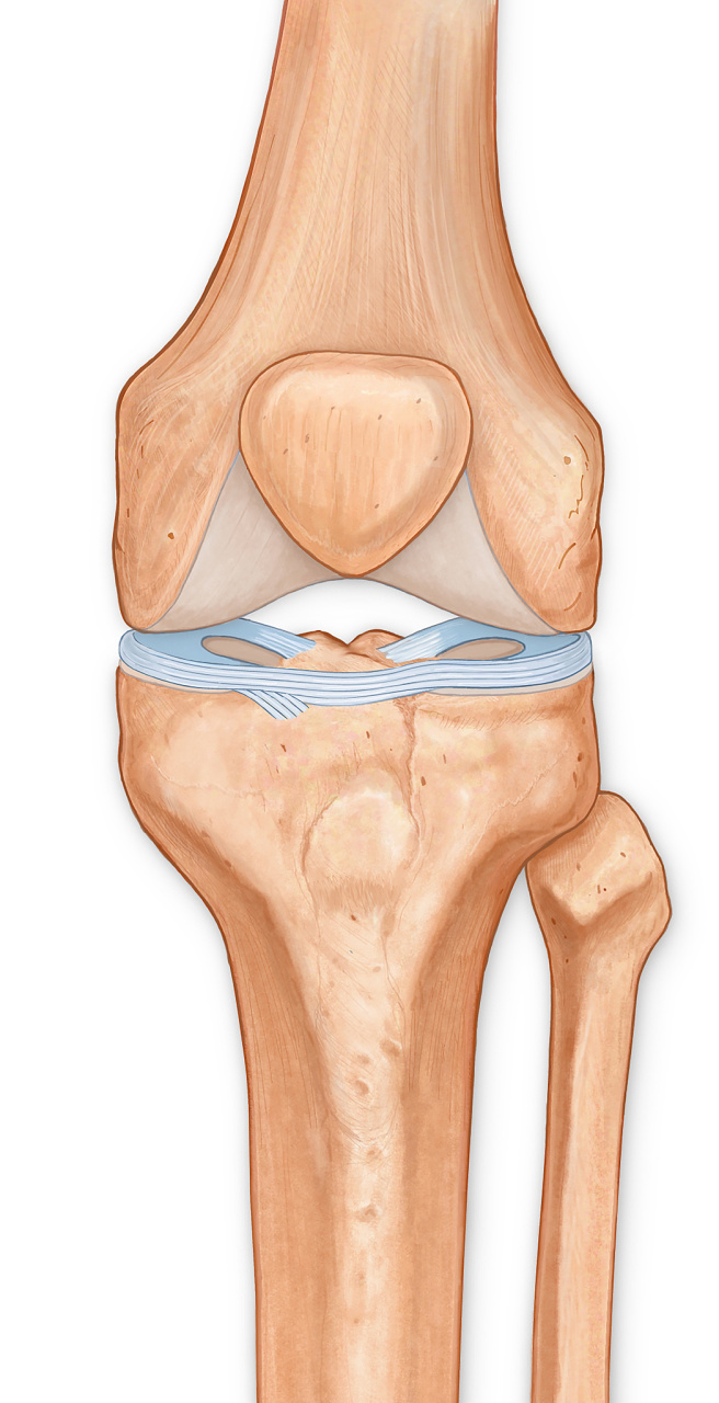 膝关节半月牙图片图片