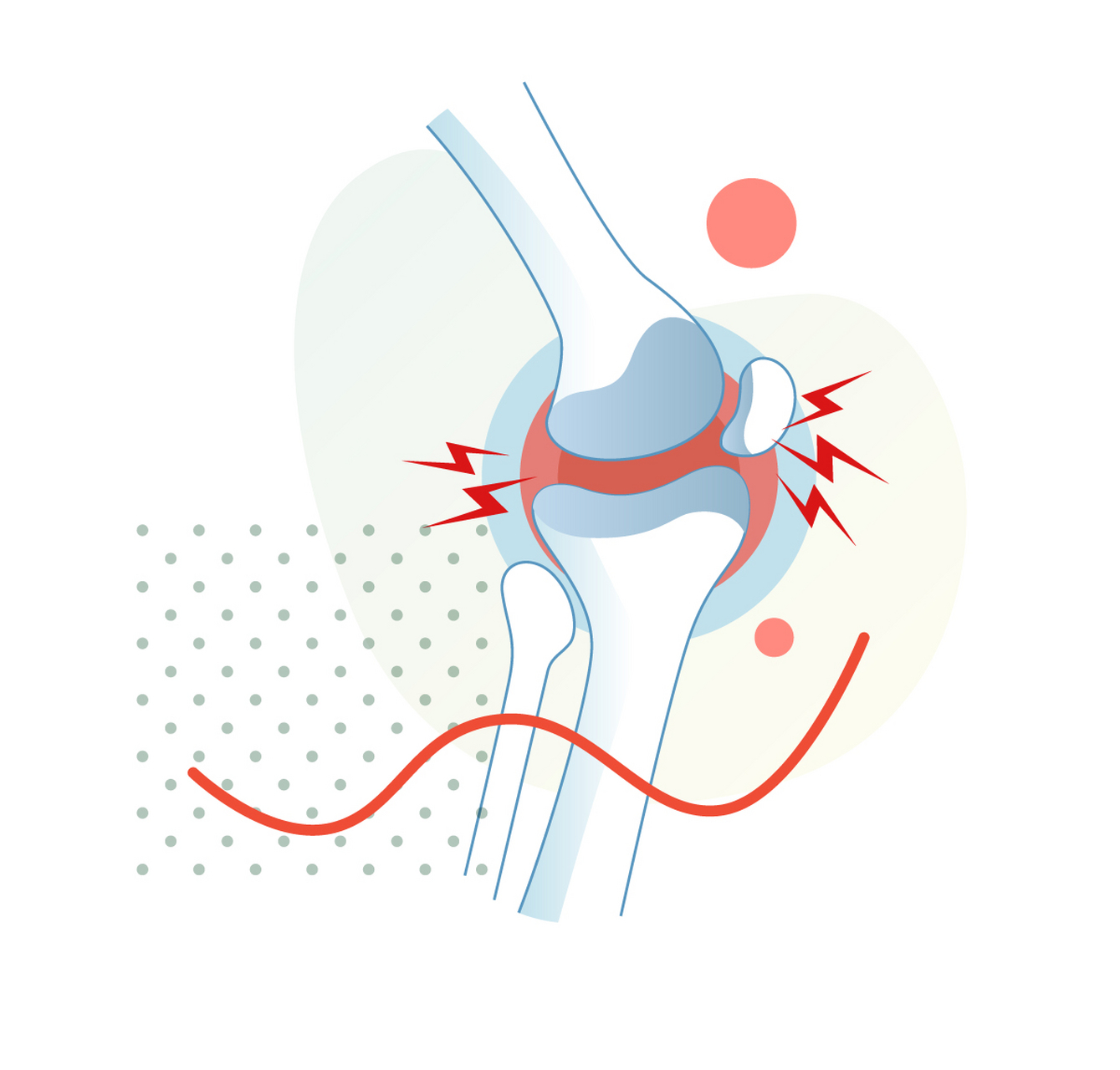 膝关节痛可以用双氯芬酸钠,塞来昔布,透明质酸钠,氨基葡萄糖,硫酸软骨