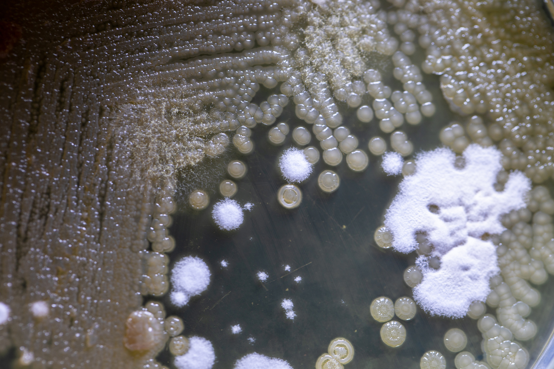 你知道抠鼻子会真菌性鼻窦炎吗?