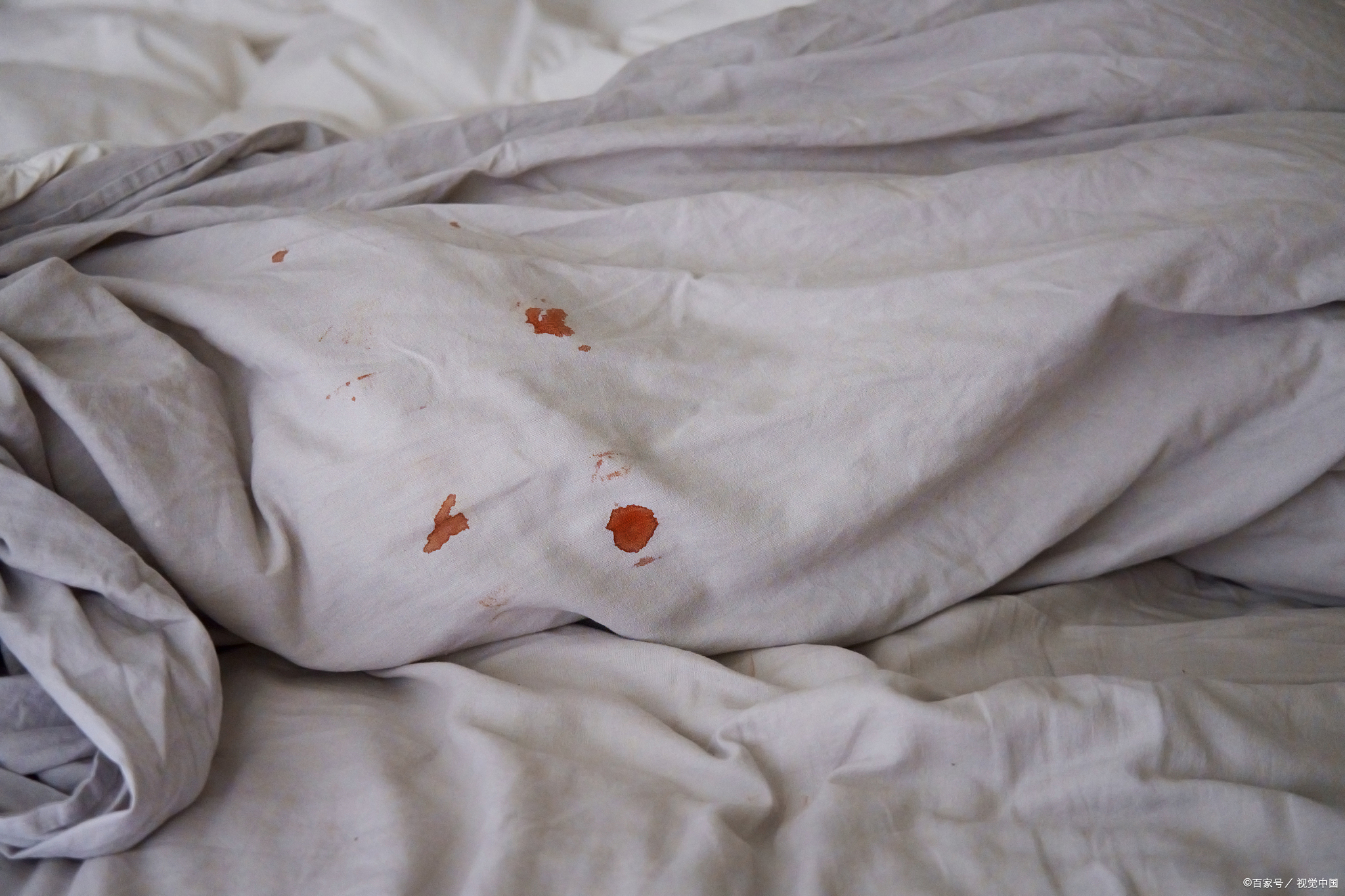 不管床单血渍多顽固,教你简单诀窍,新老血渍轻松去除,涨见识了