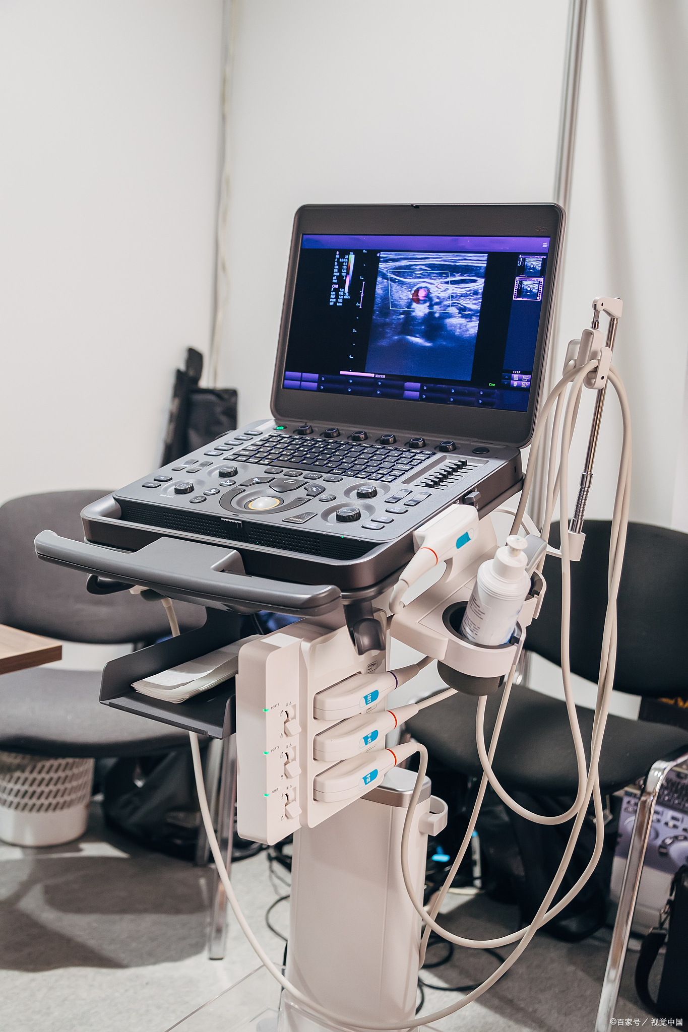 包含安定医院先进的医疗设备(今天/挂号资讯)的词条