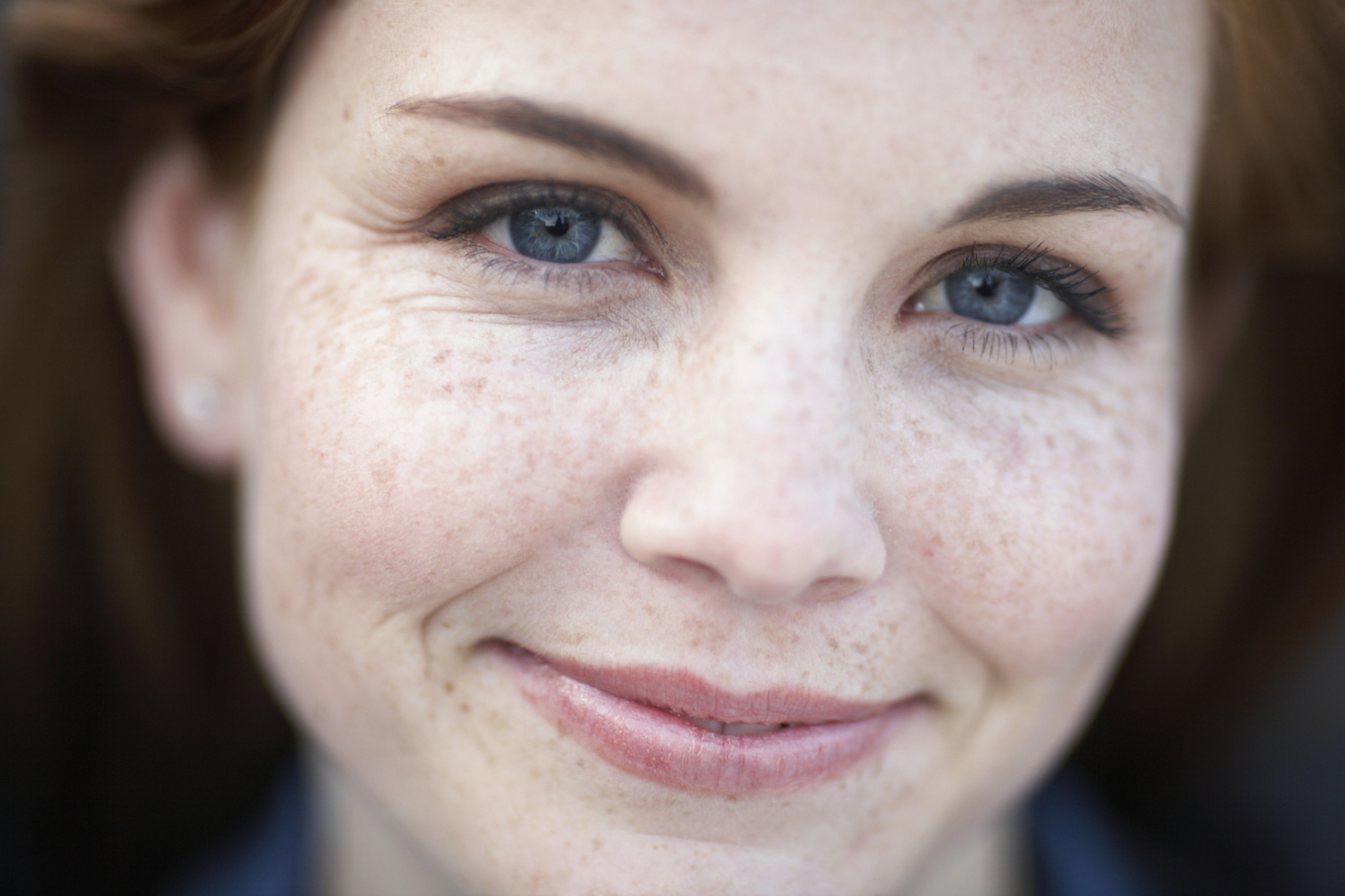 痘印能自己慢慢淡化吗  痘印如果属于轻度症状,一般会慢慢消失,如果