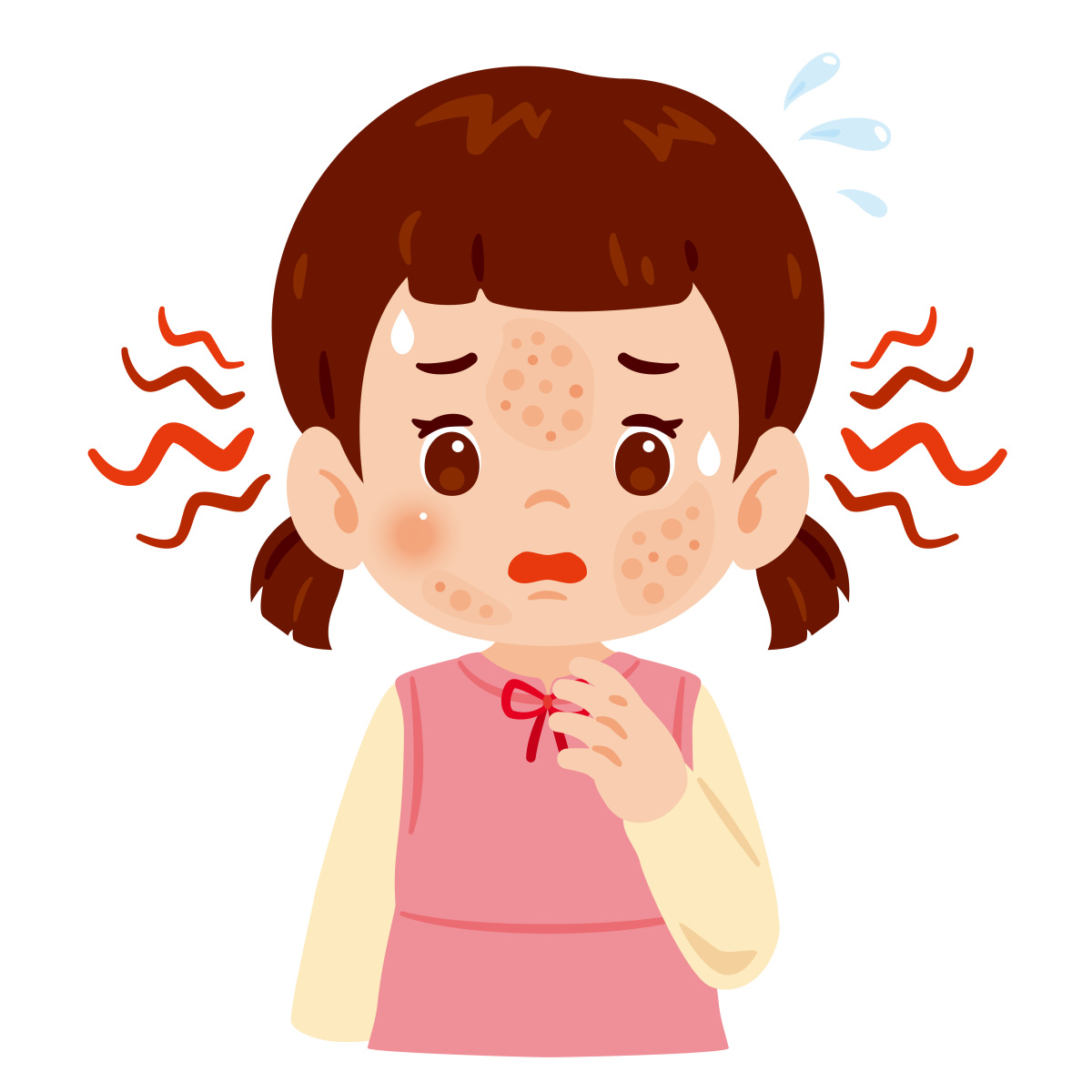 痘痘的产生往往与不良的生活习惯密切相关,如饮食不规律,缺乏运动