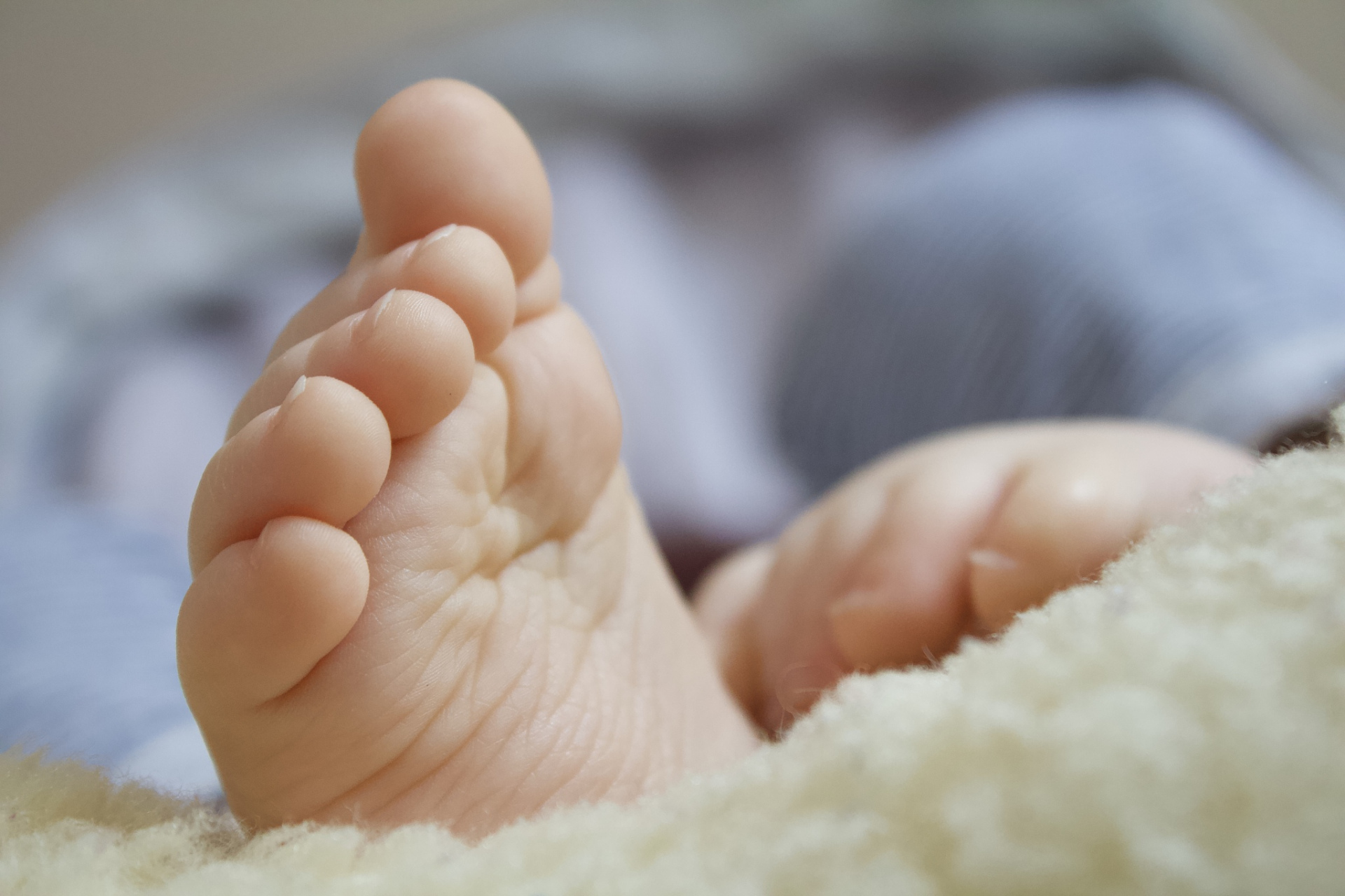 宝宝脚底板发黄,家长应该怎么办?