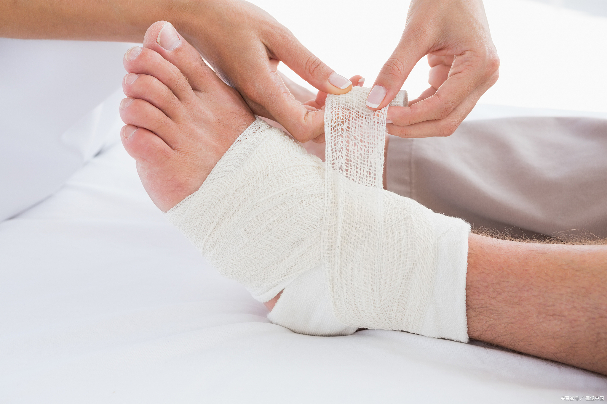 跑步扭伤了是否可以热敷,取决于扭伤后的时间以及症状的严重程度