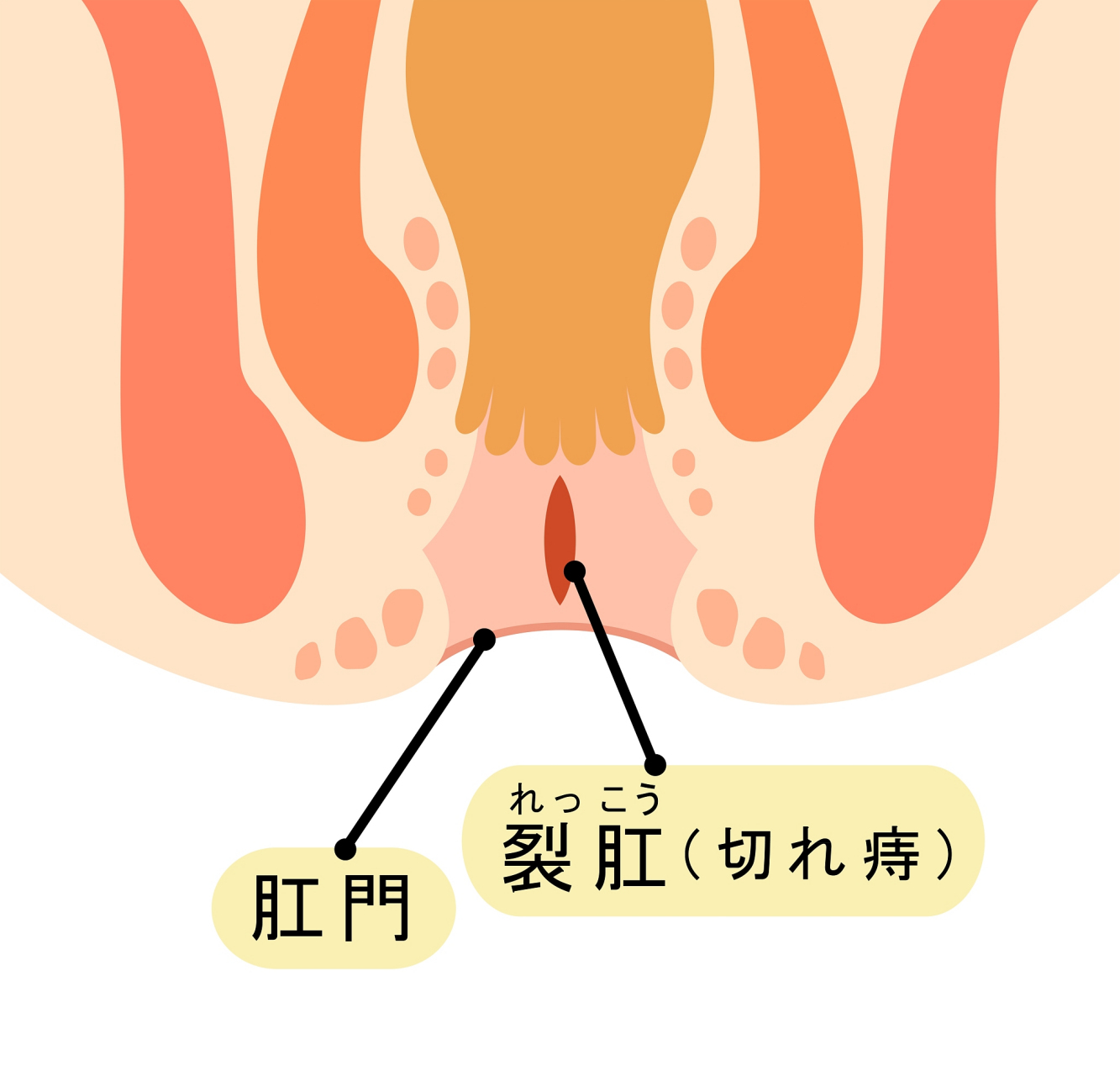 你是不是也遇到过这样的尴尬时刻