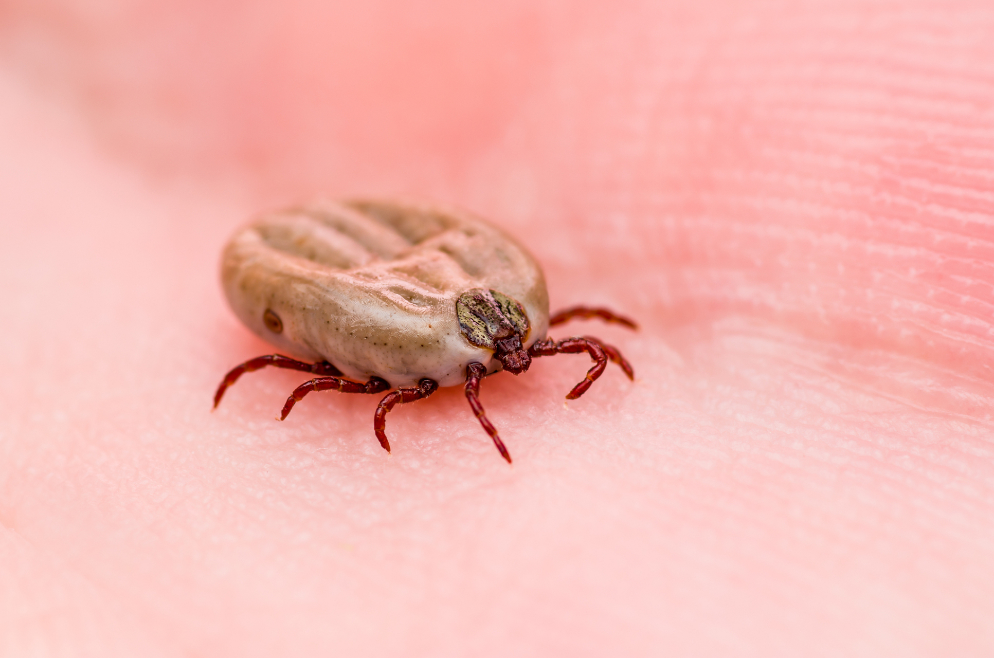 【#1个月大男婴被蜱虫叮咬险丧命#不慎被蜱虫咬了该怎么办?