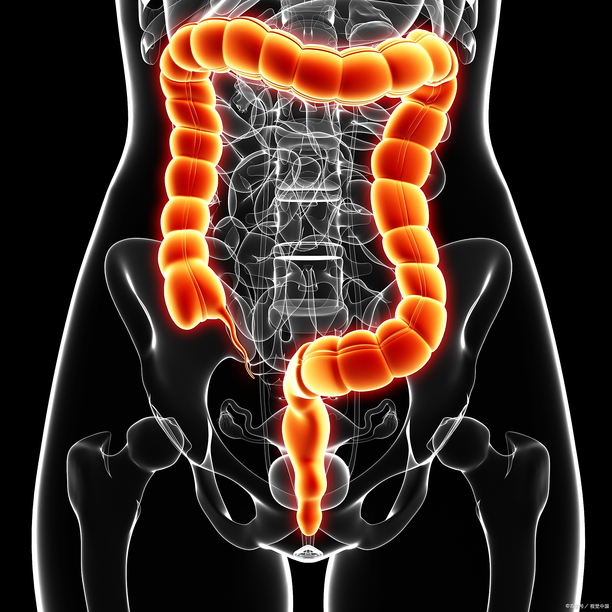 5mm以下直肠病变可用热活检钳咬除术 对于结直肠癌前病变的治疗原则