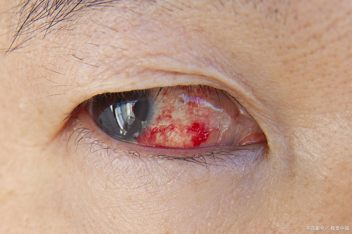 眼睛里有颗粒磨的感觉是怎么回事 许多人都曾遇到过