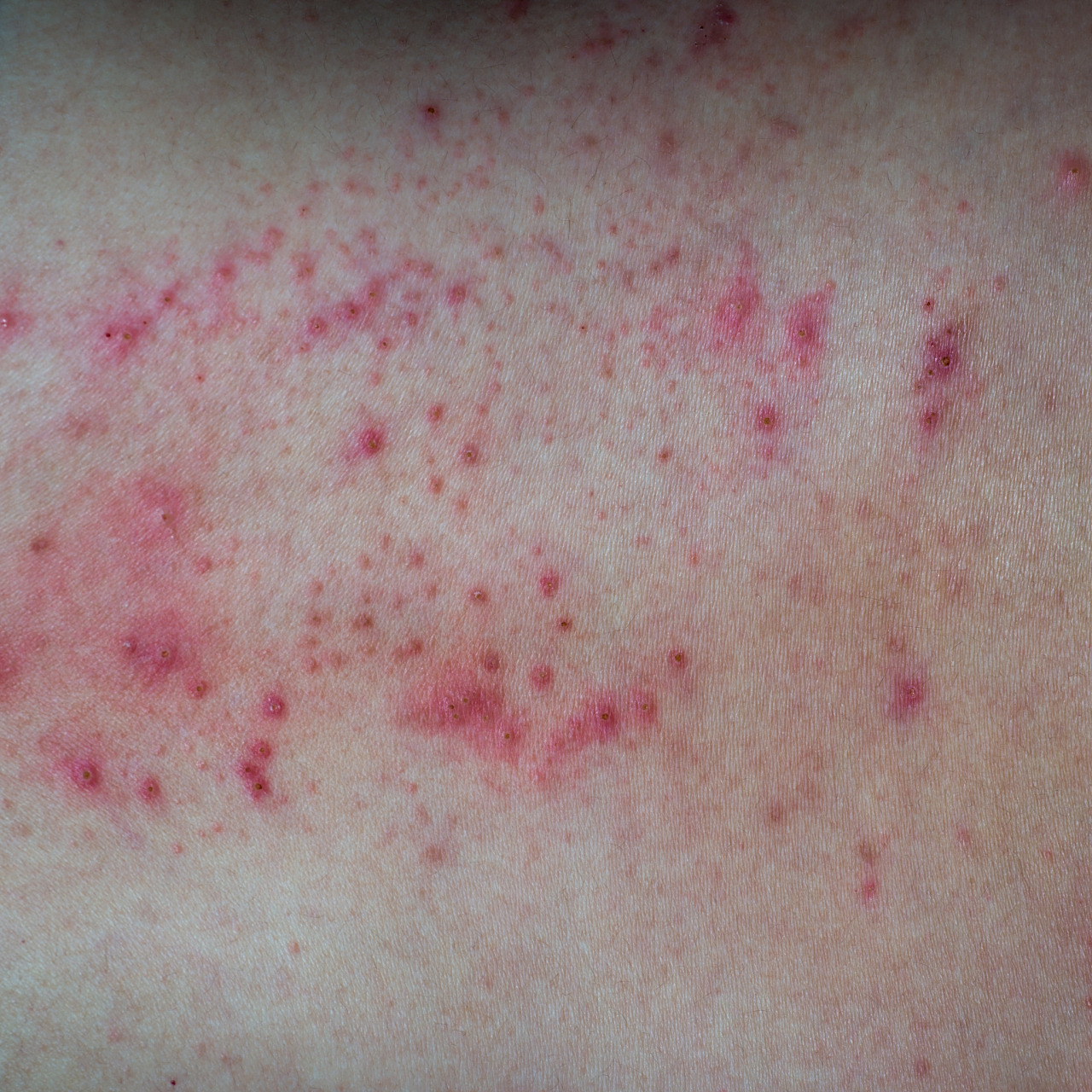 男人生殖器上有白色的像豆腐渣是病吗	  男人生殖器上有白色的像豆腐