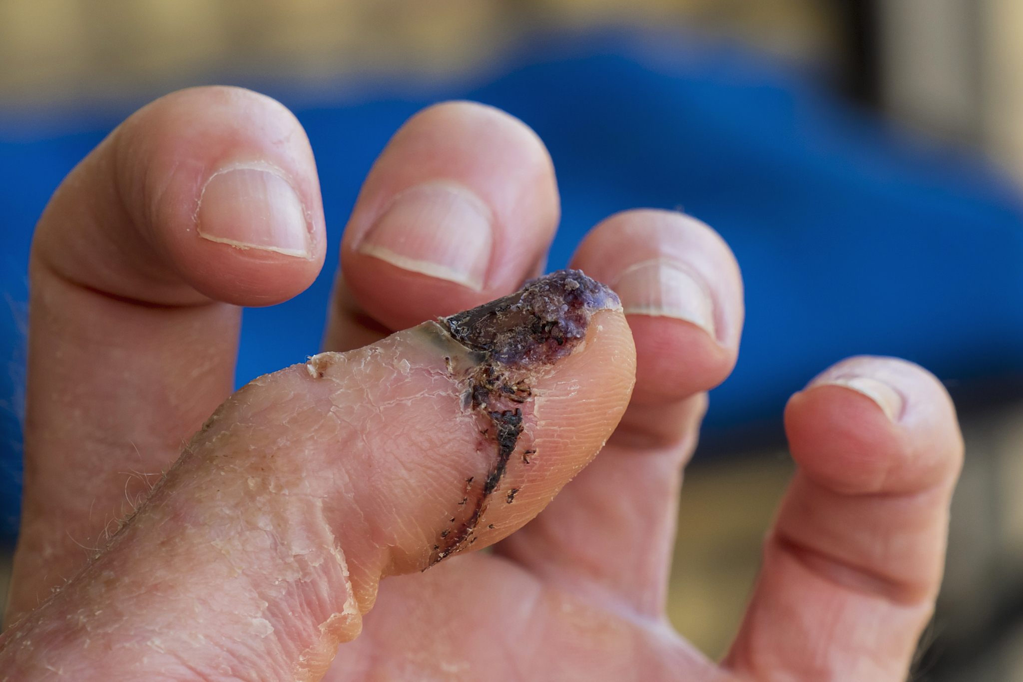 同事与教练商议退款,同时探讨全额退款的方法