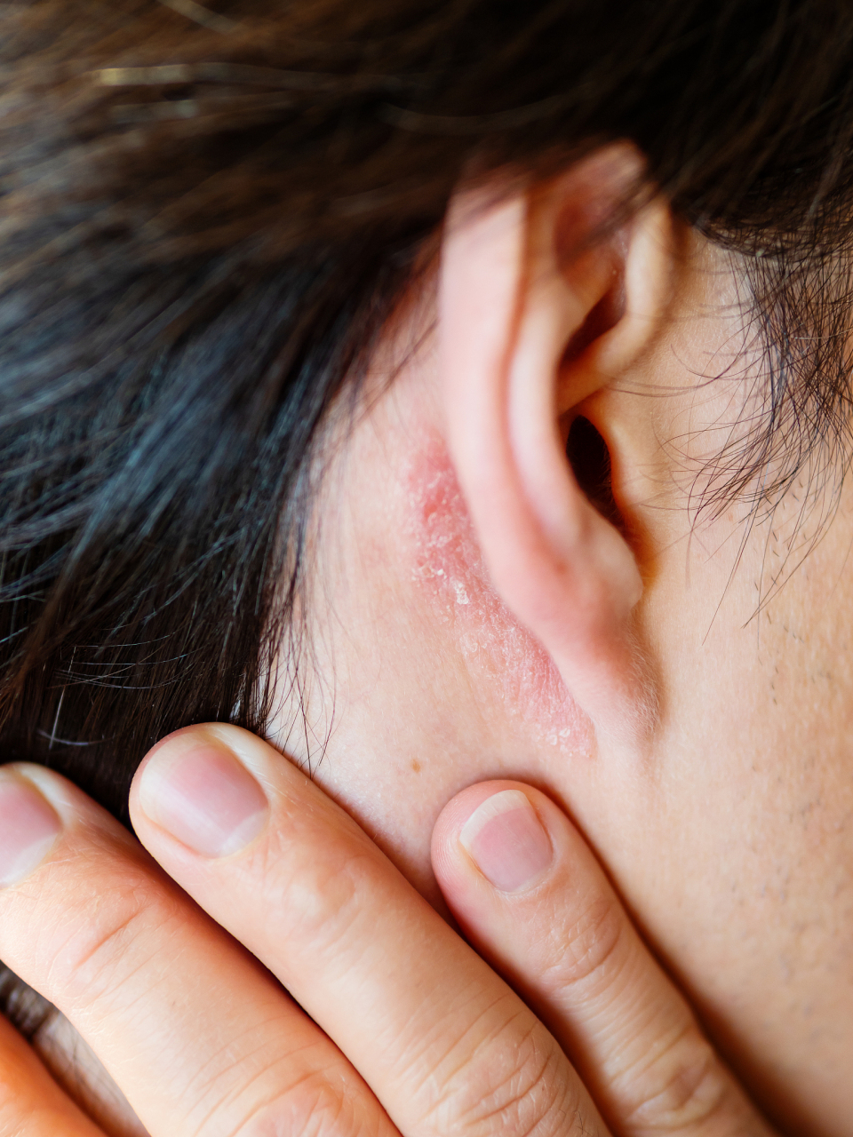 这是许多人在日常生活中会经历的问题,即使没有其他症状,耳朵痒也让人