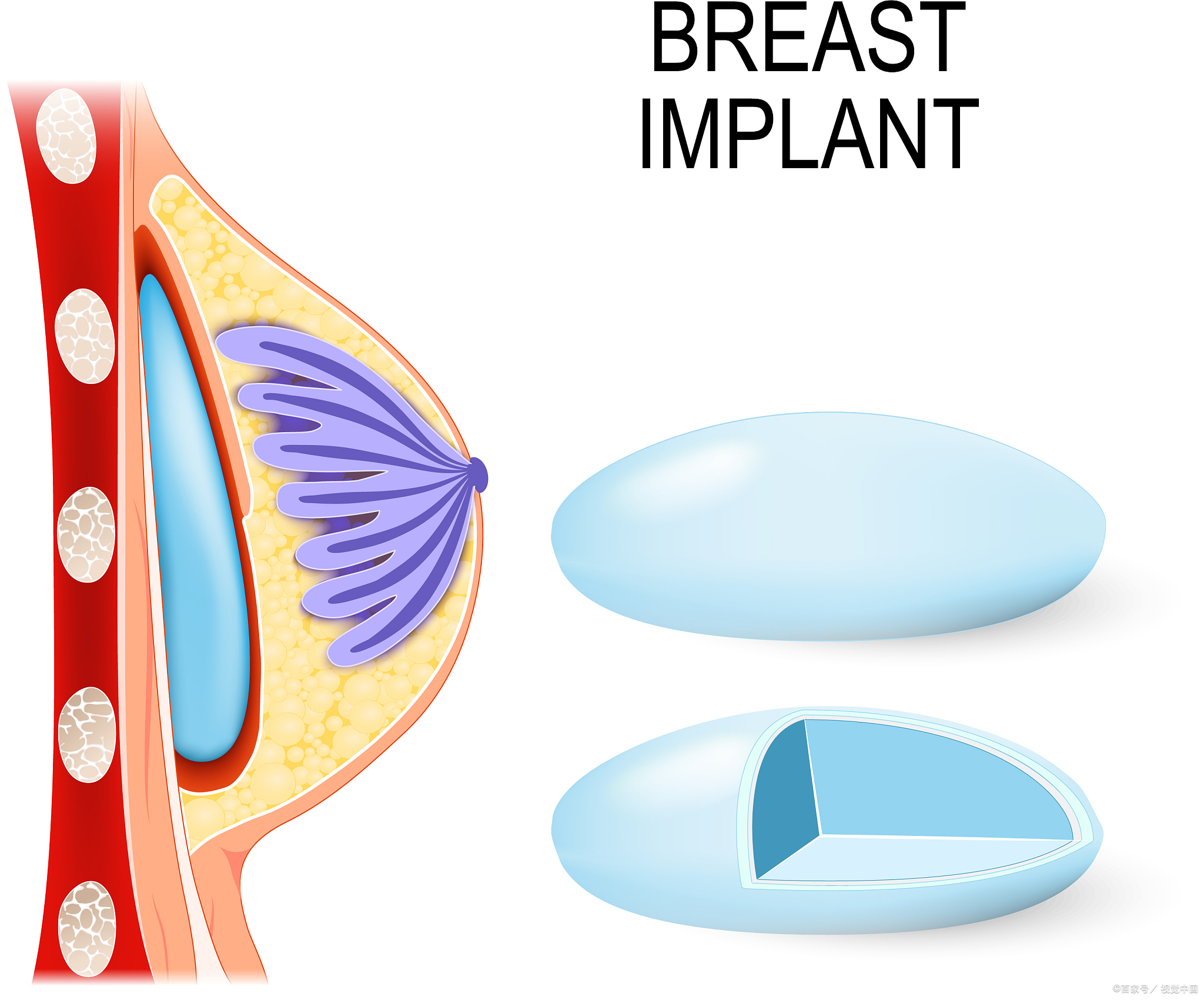 乳房再造手术患者自述图片