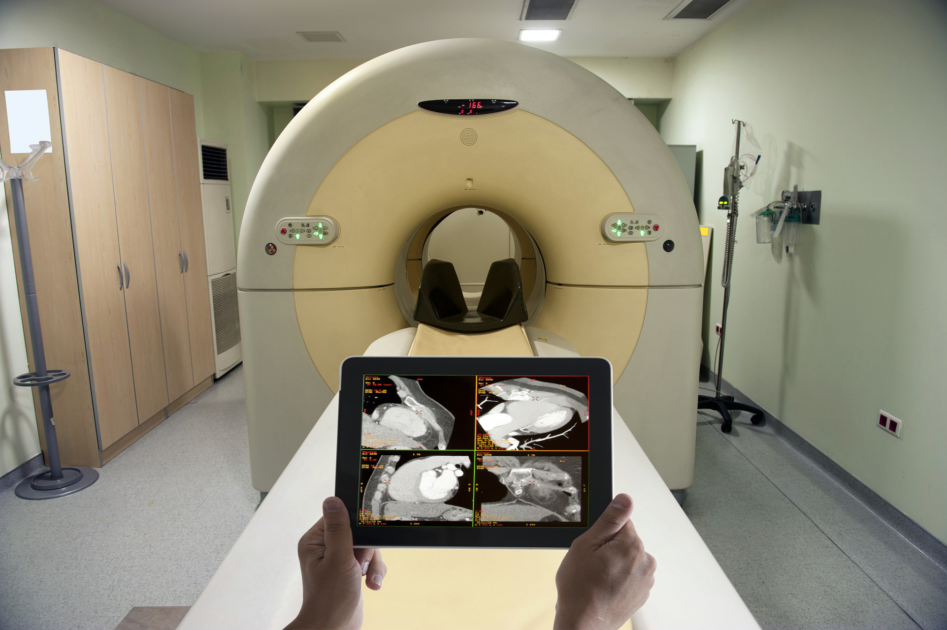 乳腺x线摄影在诊断乳腺癌上有什么作用?